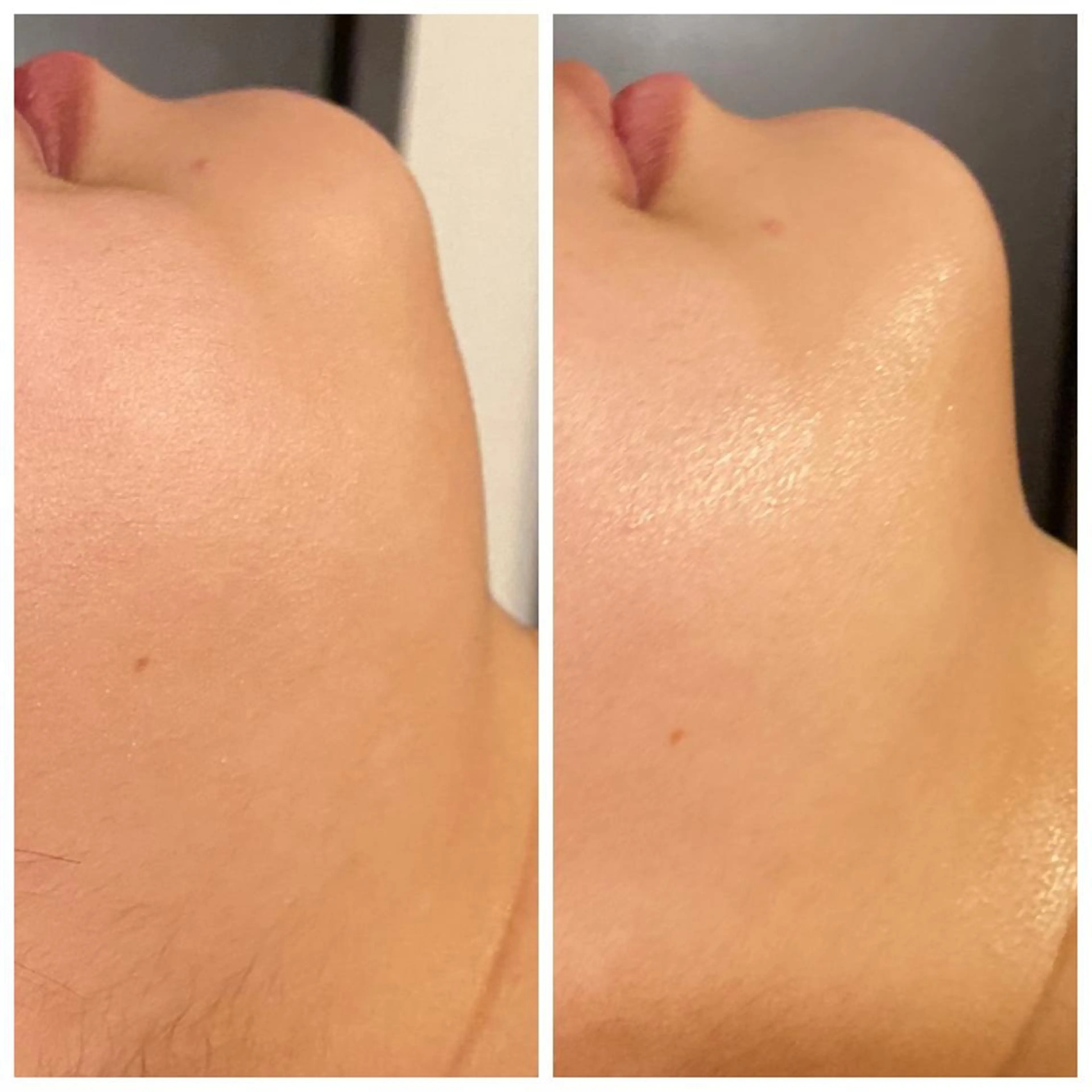 Mandarin Orange所属・毛穴から始める肌メン テマンダリンオレンジのエステ・リラクイメージ