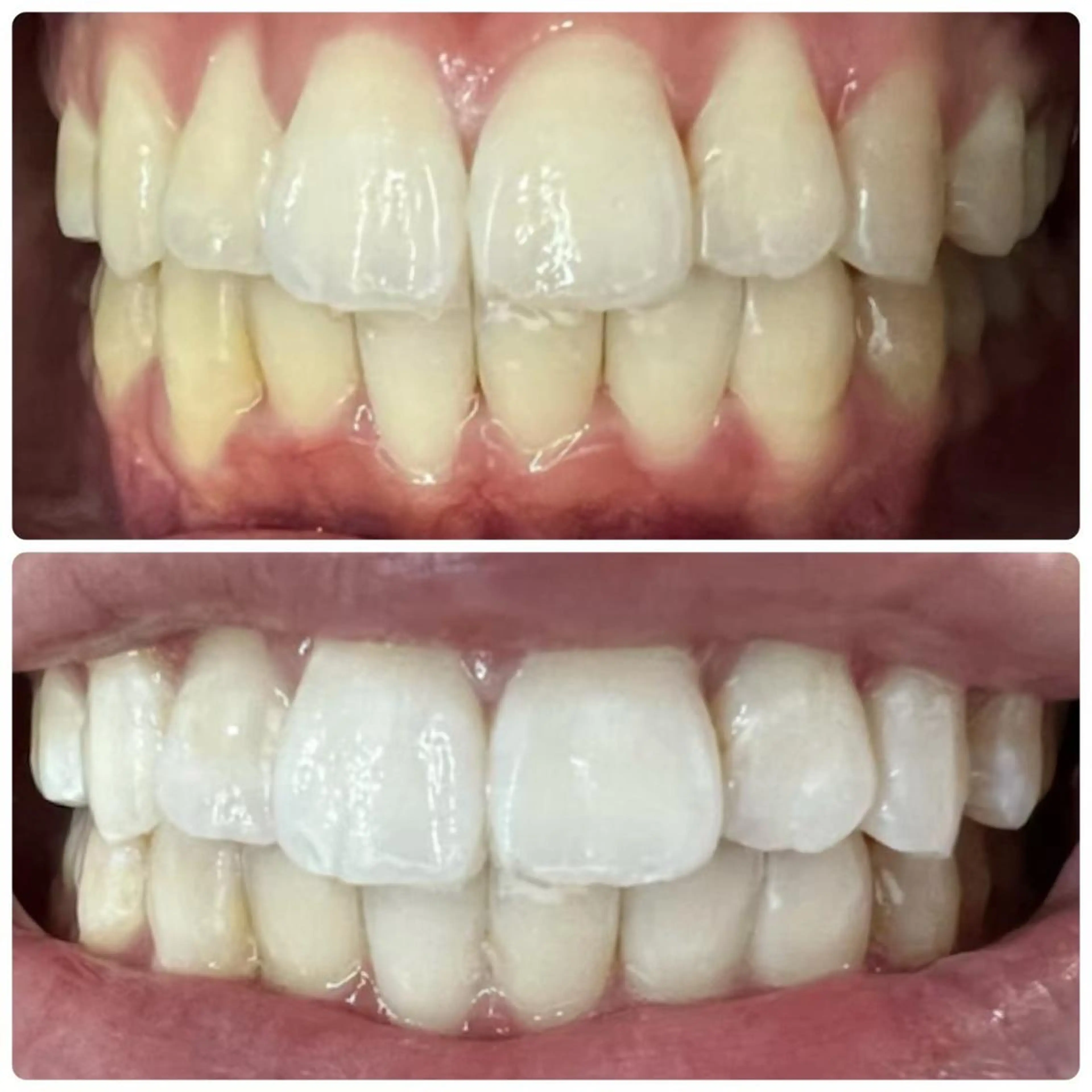 その他 LOVE ホワイトニング戸辺のその他イメージ