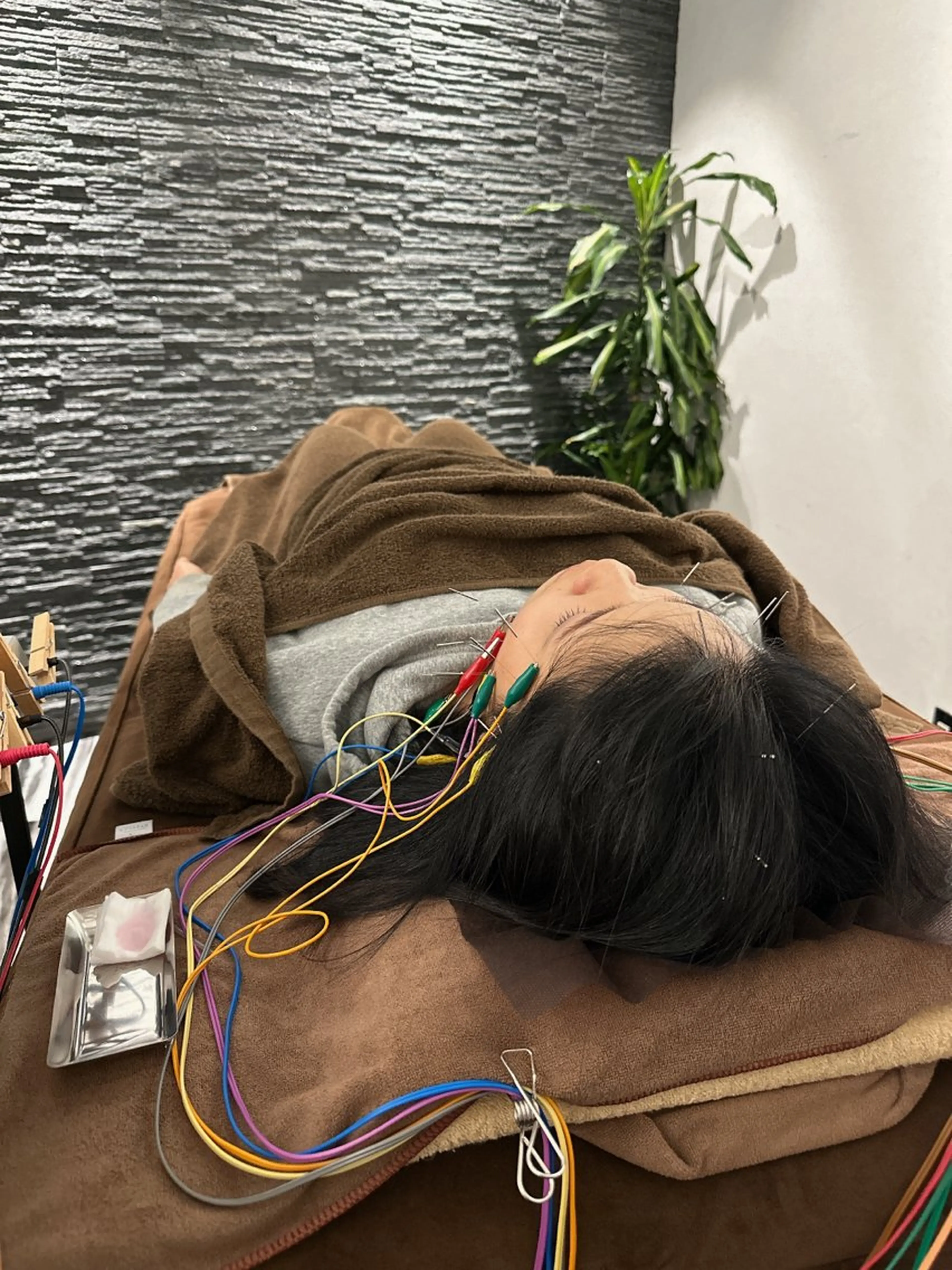 その他 美容鍼灸整体サロンBeauJu所属・小顔矯/美容鍼/鍼灸 BeauJuのその他イメージ