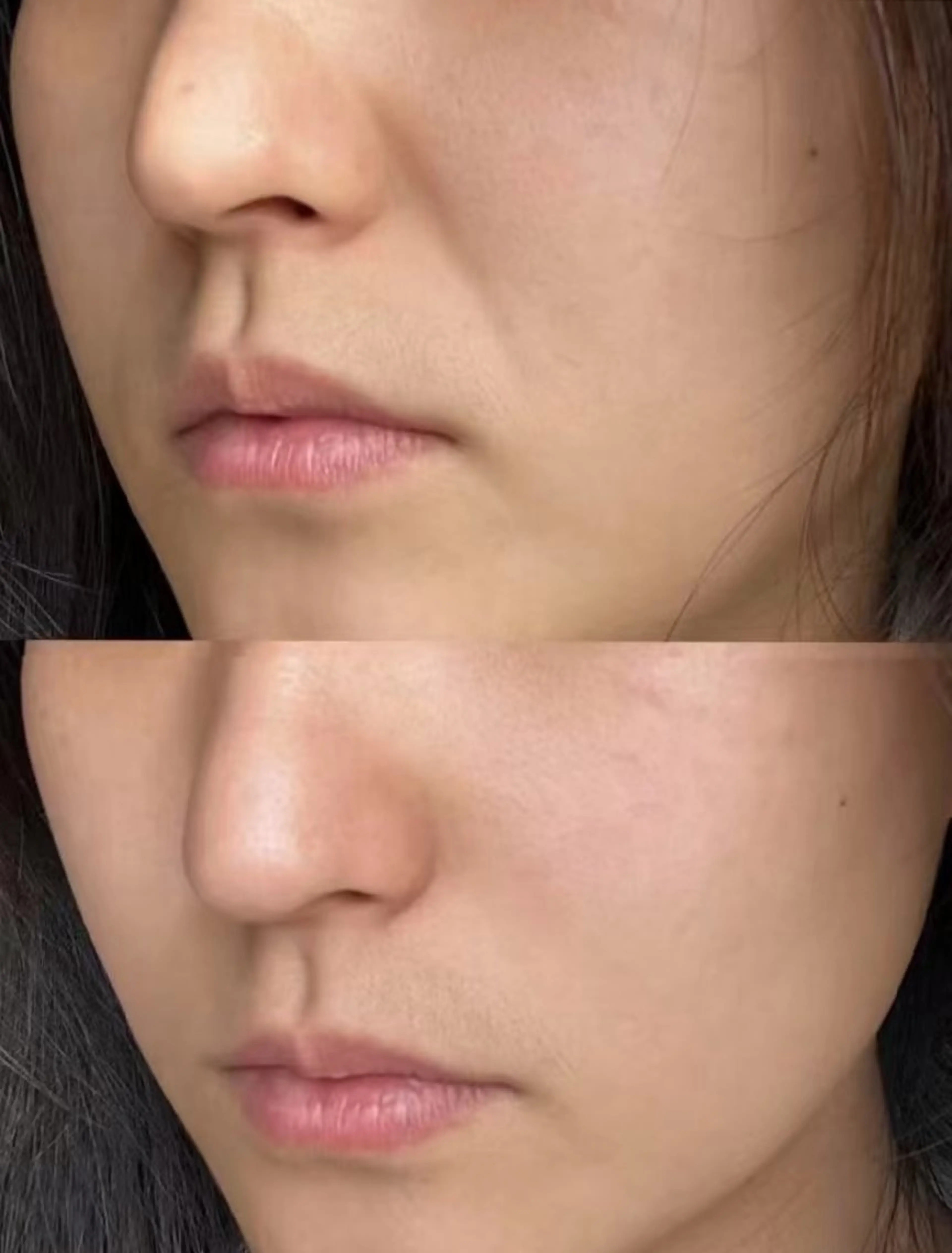 エステ aliaハーブ水光店 エステティシャン募集のエステ・リラクイメージ