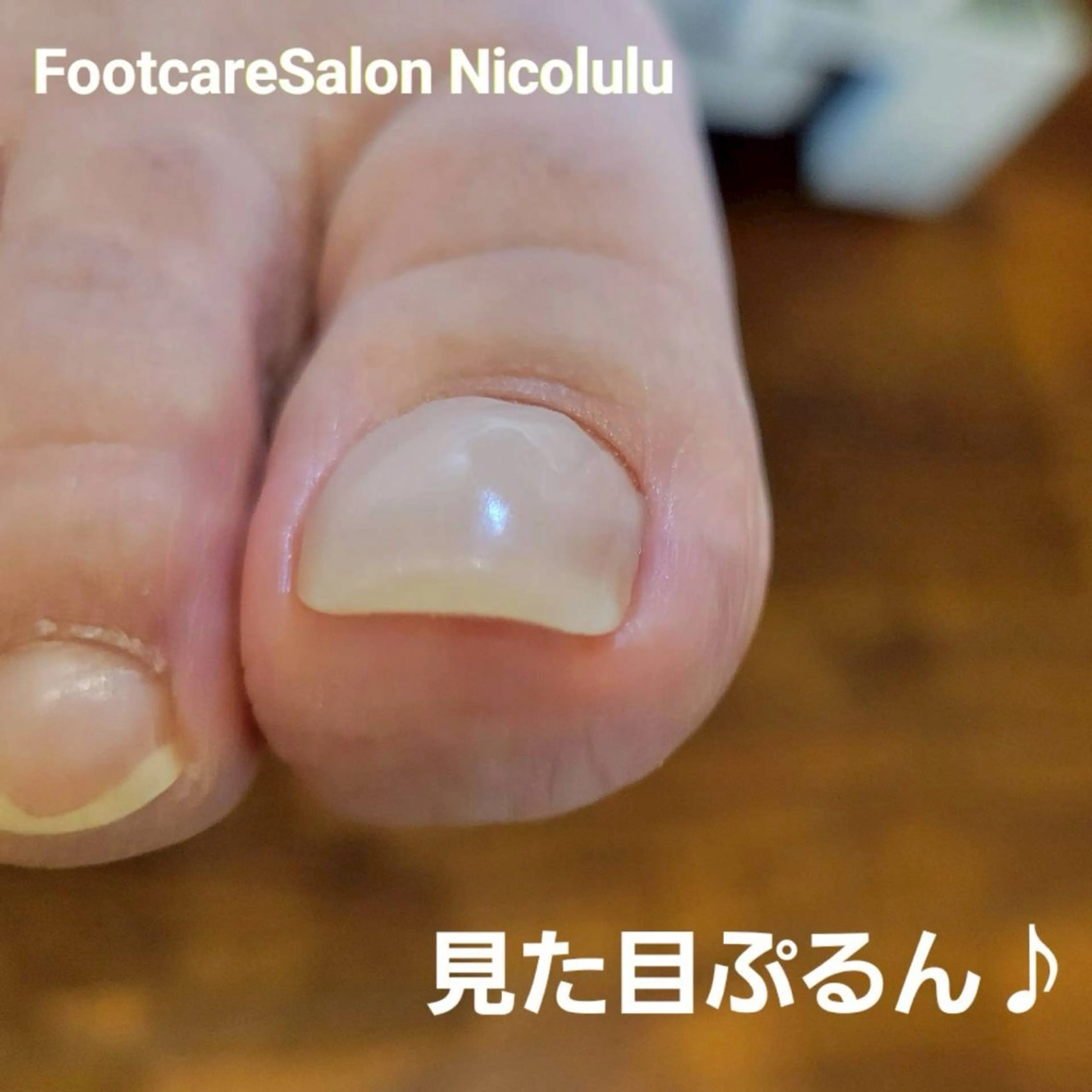 リラク 足トラブル専門 ニコルル金沢のエステ・リラクイメージ