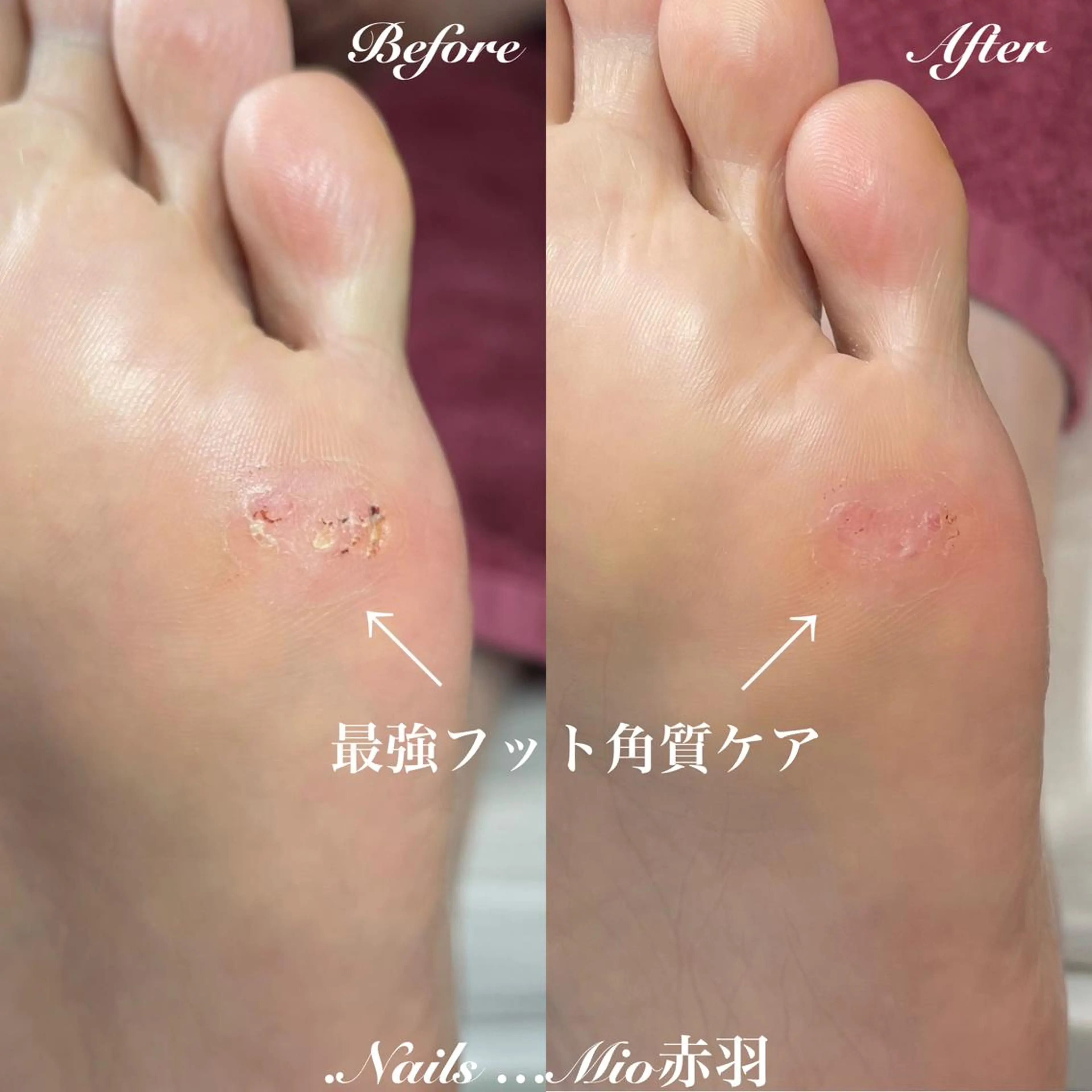 ネイル フットネイル .Nails Mio 赤羽西ネイルサロンのネイルデザイン