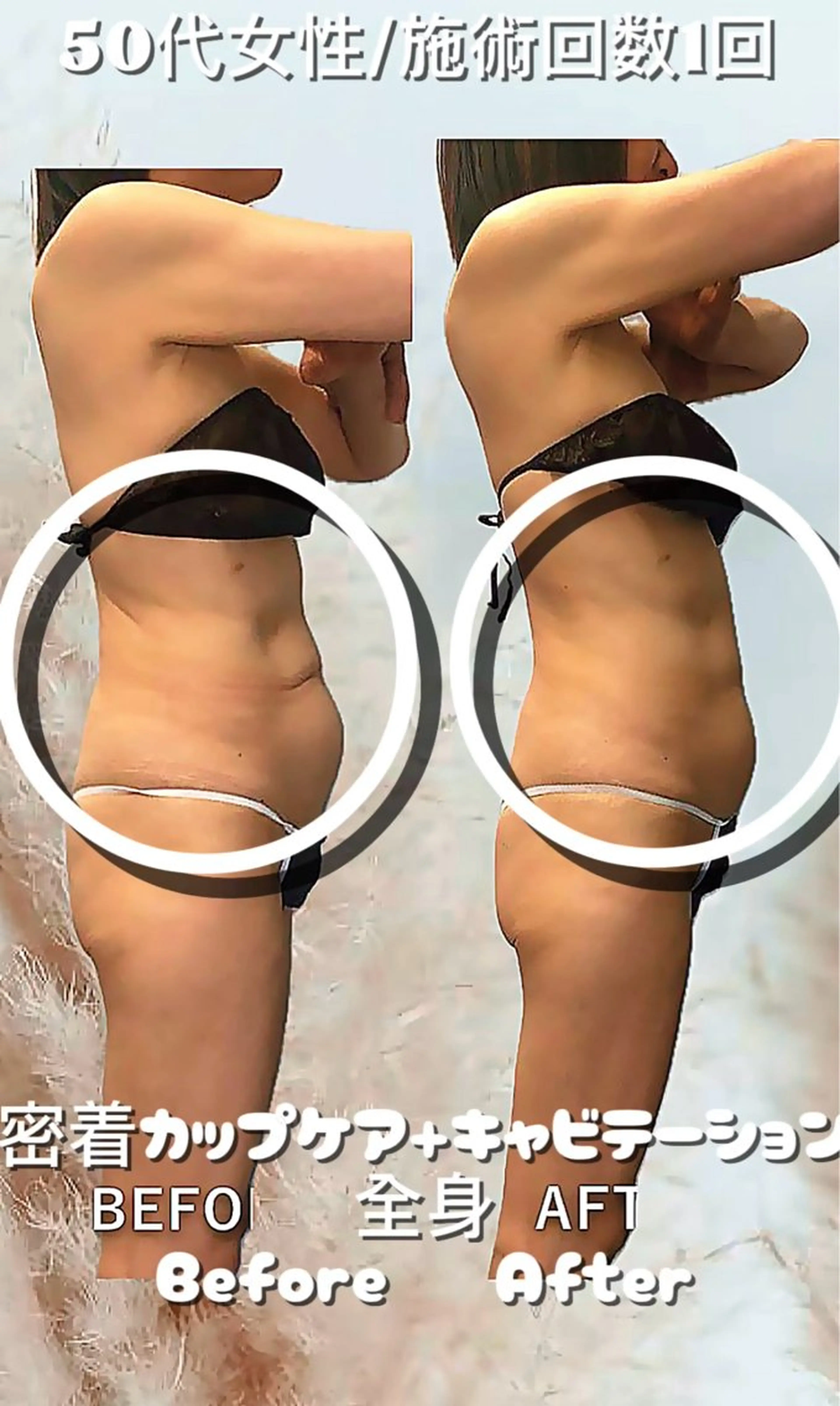 エステ 美容整体・塗る漢方・フェイシャルRechica所属・痩身・脱毛・肌管理 Rechica心斎橋のエステ・リラクイメージ