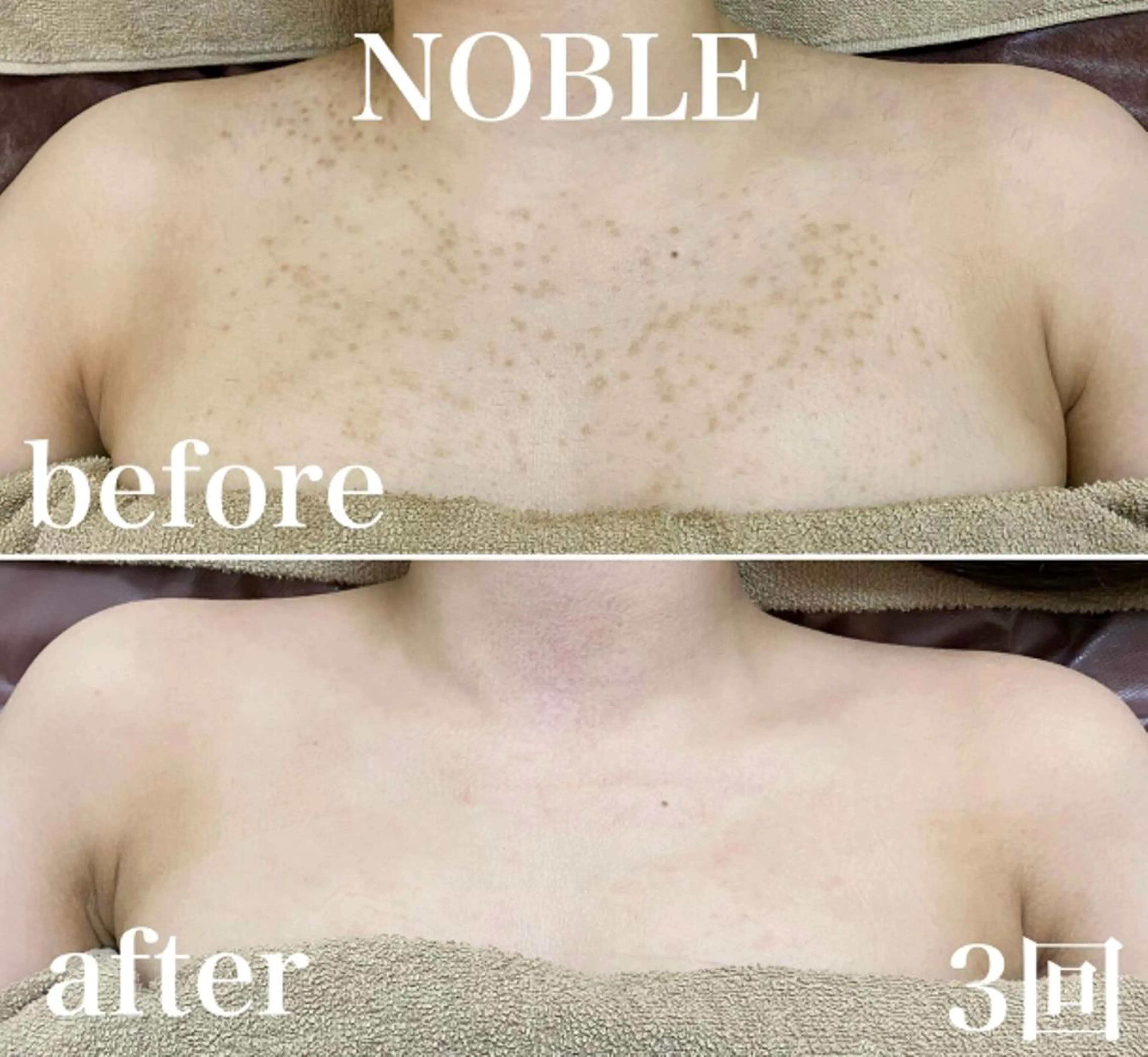 NOBLE 新宿南口店のエステ・リラクイメージ