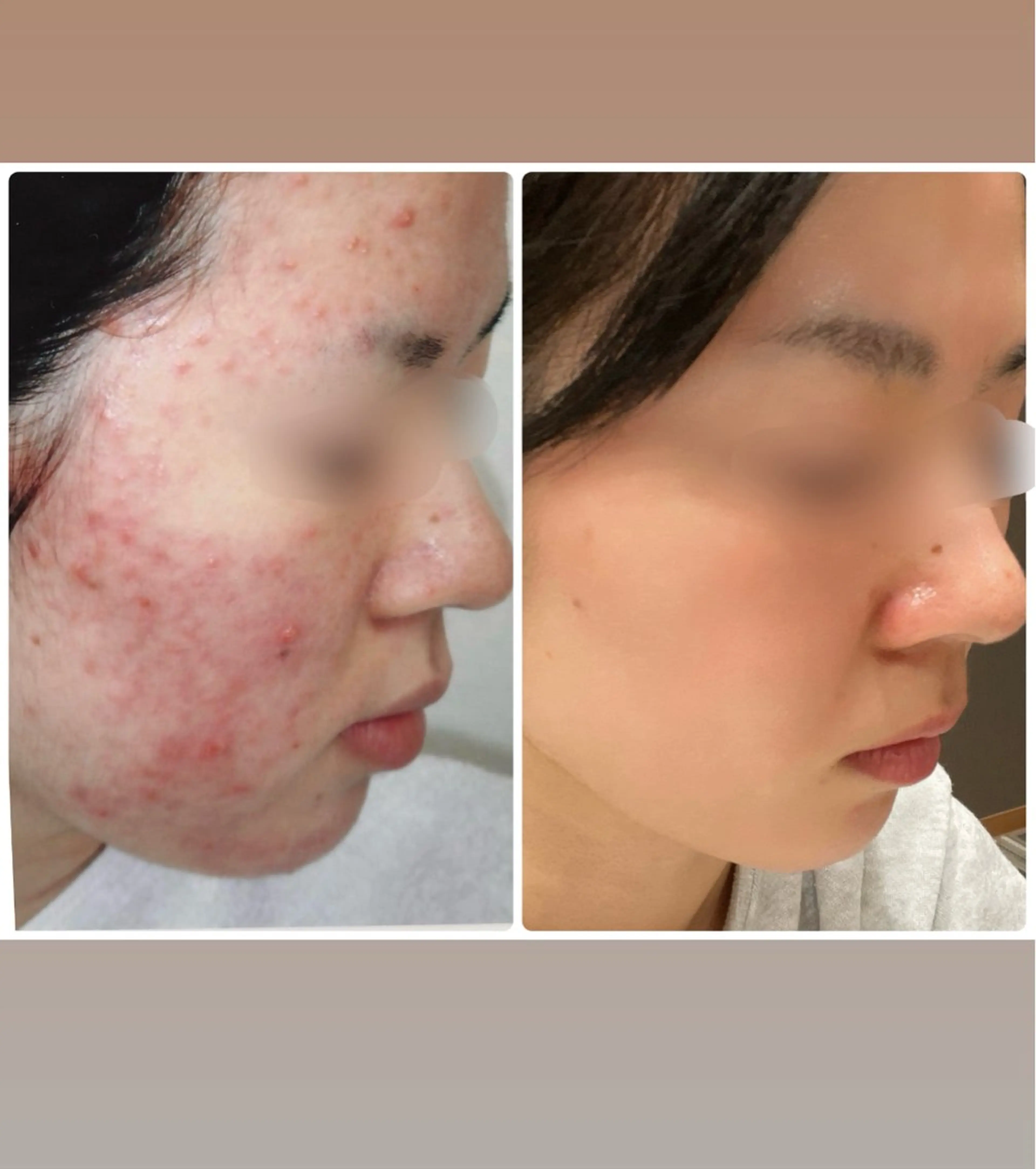 パーソナルスキンケア 🦋APRI🅿️有のエステ・リラクイメージ