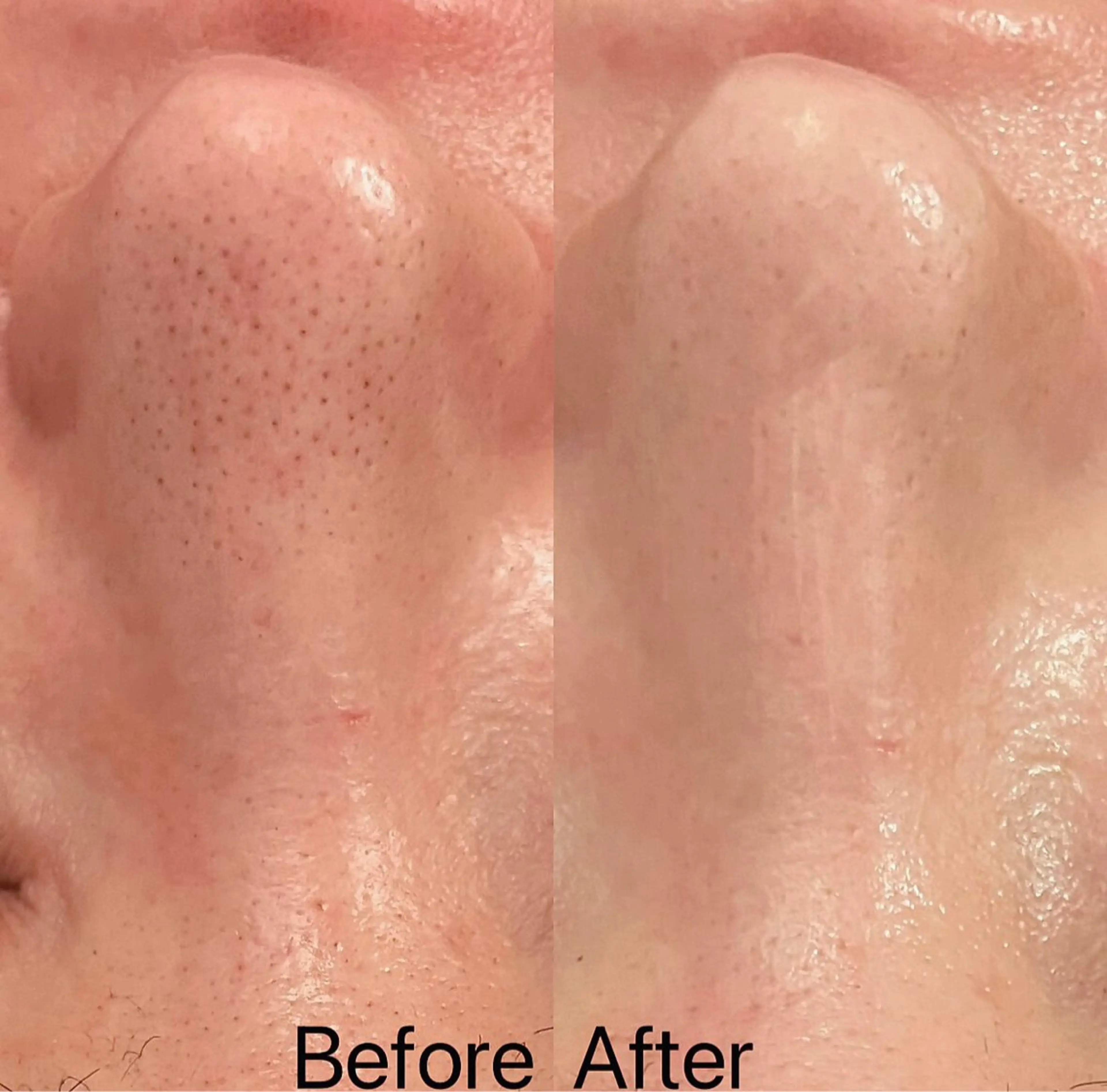 エステ Ginza Charerのエステ・リラクイメージ