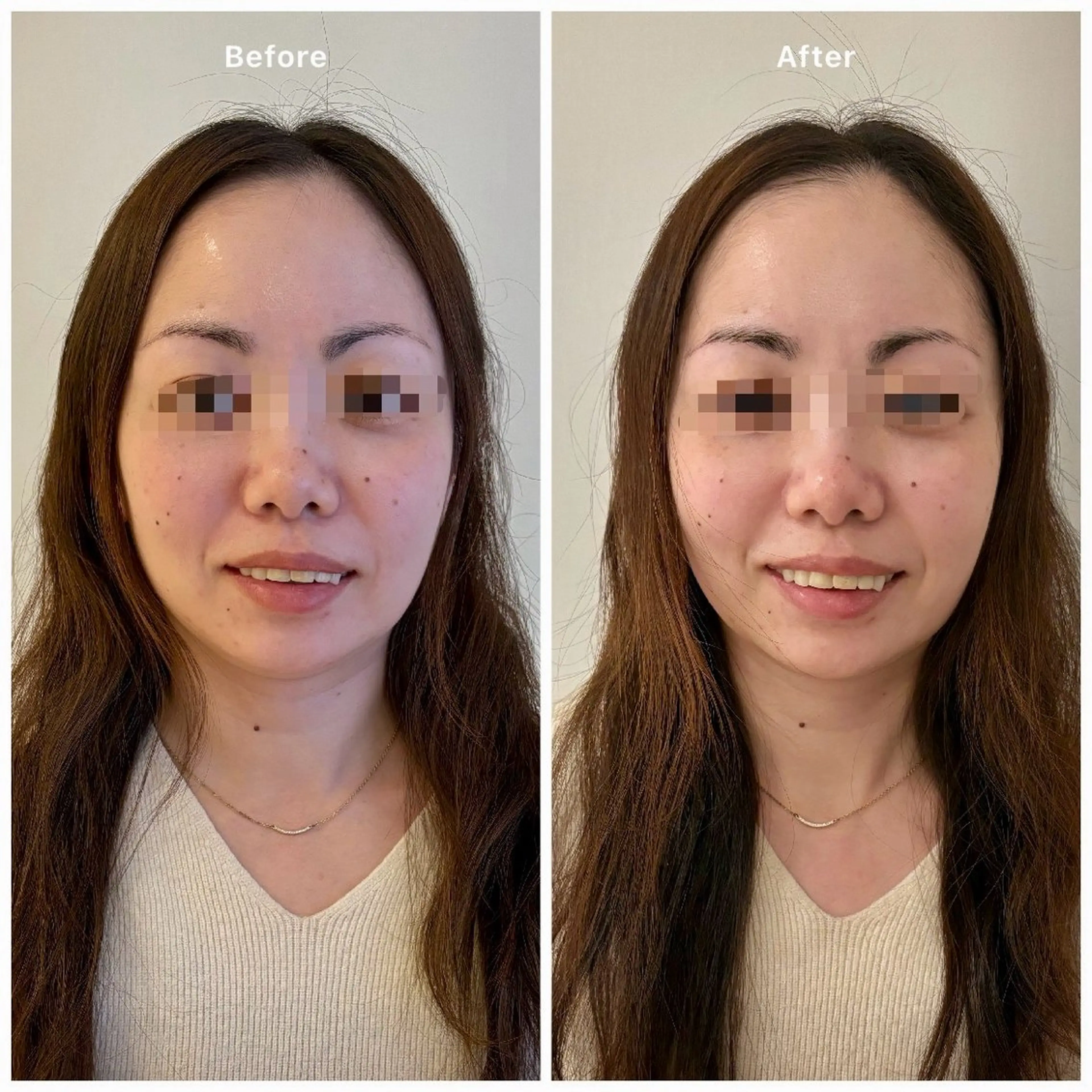 color world canna hair maison所属・OSAKI MAI⌘ 鍼灸師/本格肌管理⌘のエステ・リラクイメージ