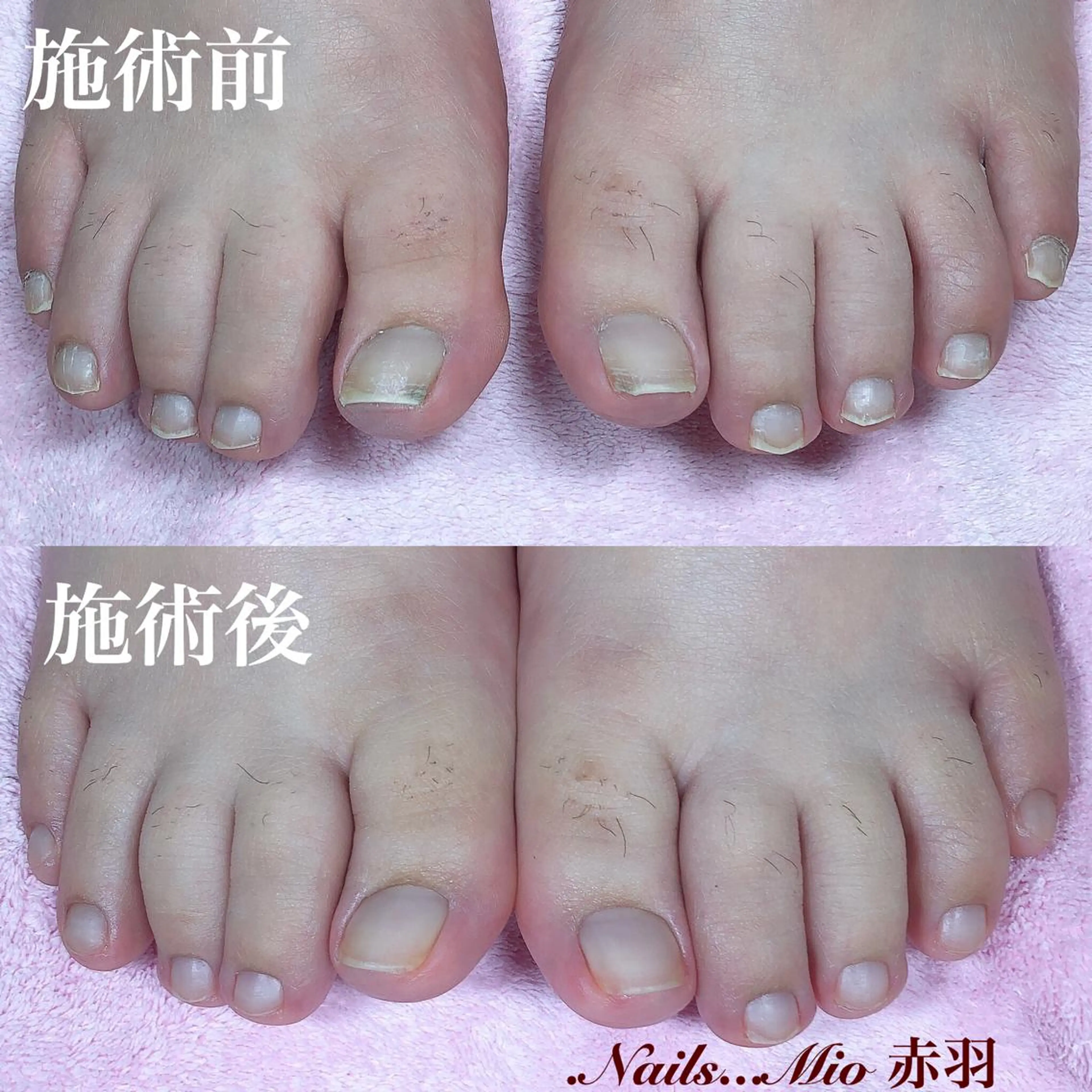 ネイル .Nails Mio 赤羽西ネイルサロンのネイルデザイン