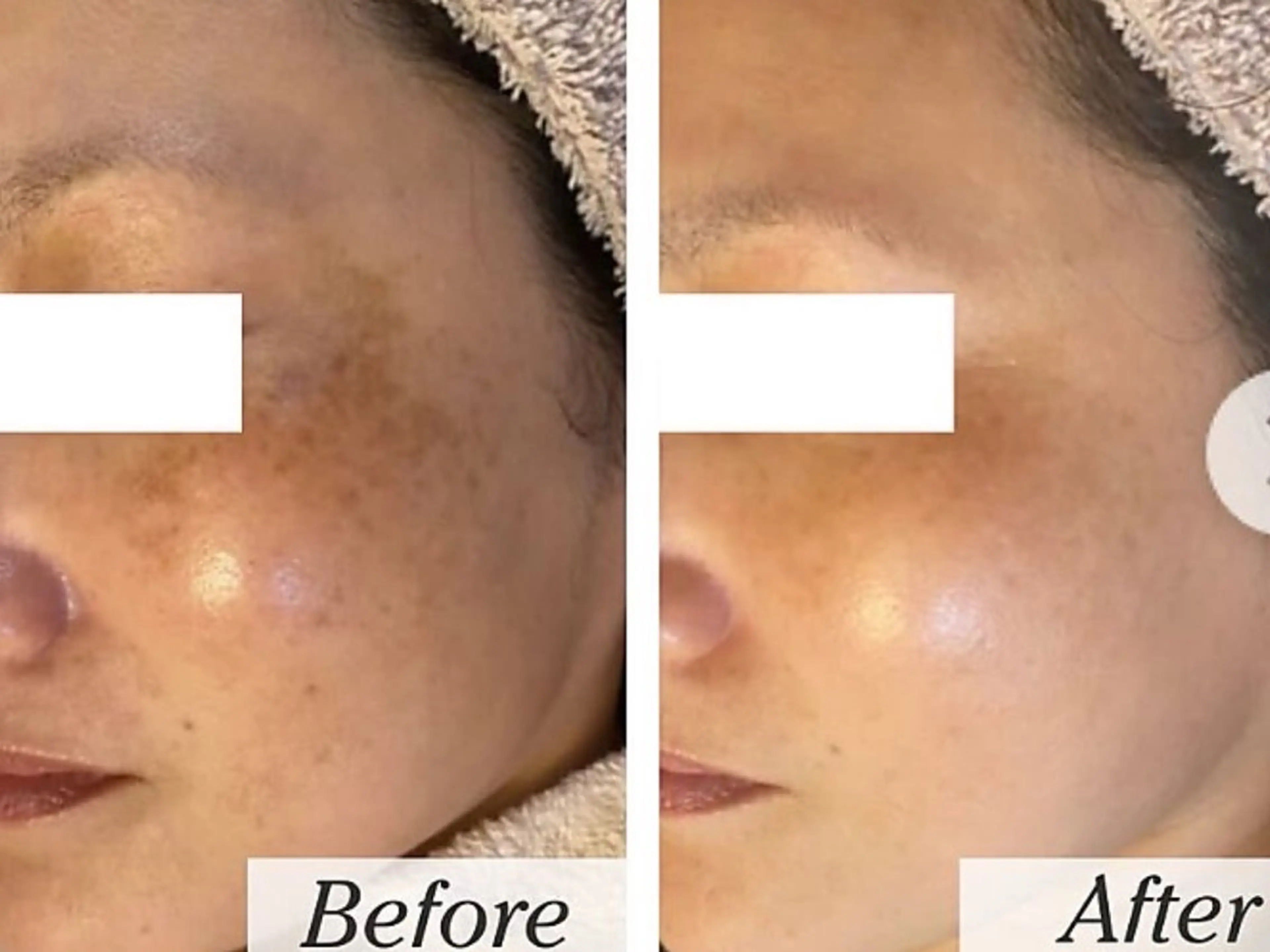 エステ シミケア専門サロンLICCO’S所属・シミケア専門サロン LICCO’S岡崎のエステ・リラクイメージ