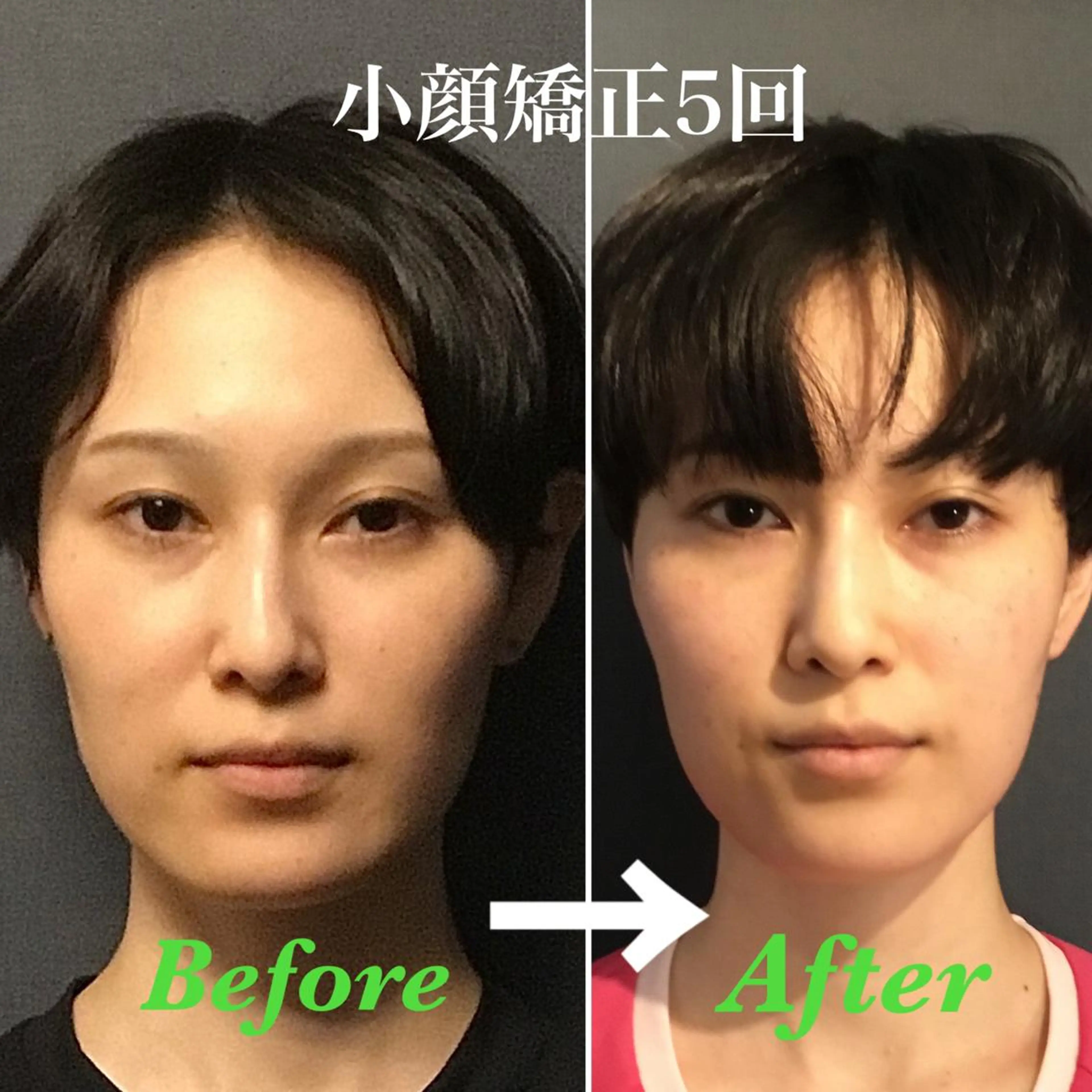 エステ リラク 骨格美容整体 bimote.新宿のエステ・リラクイメージ