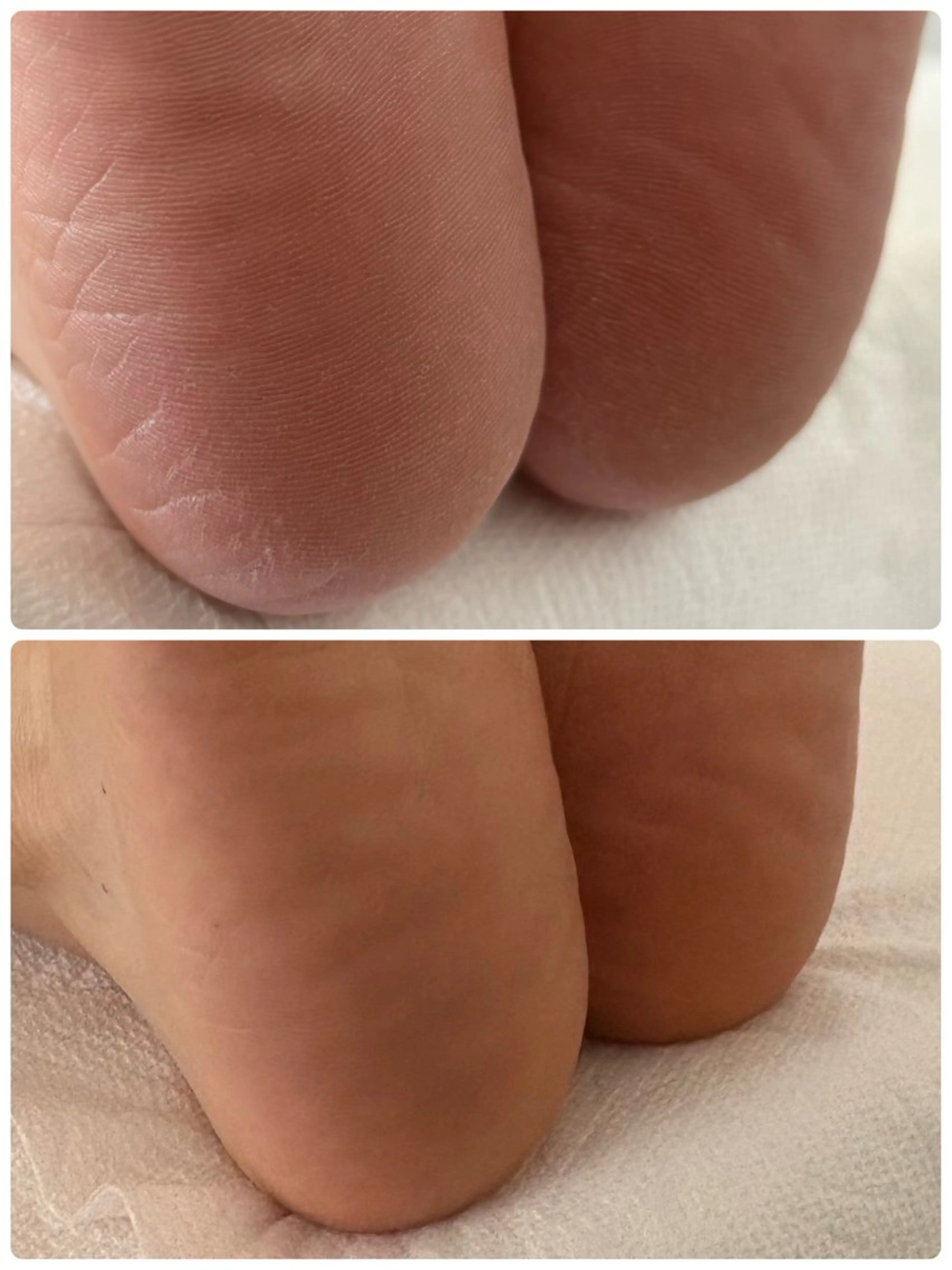 ネイル フットネイル その他(ネイル) non nail ⭐︎のネイルデザイン