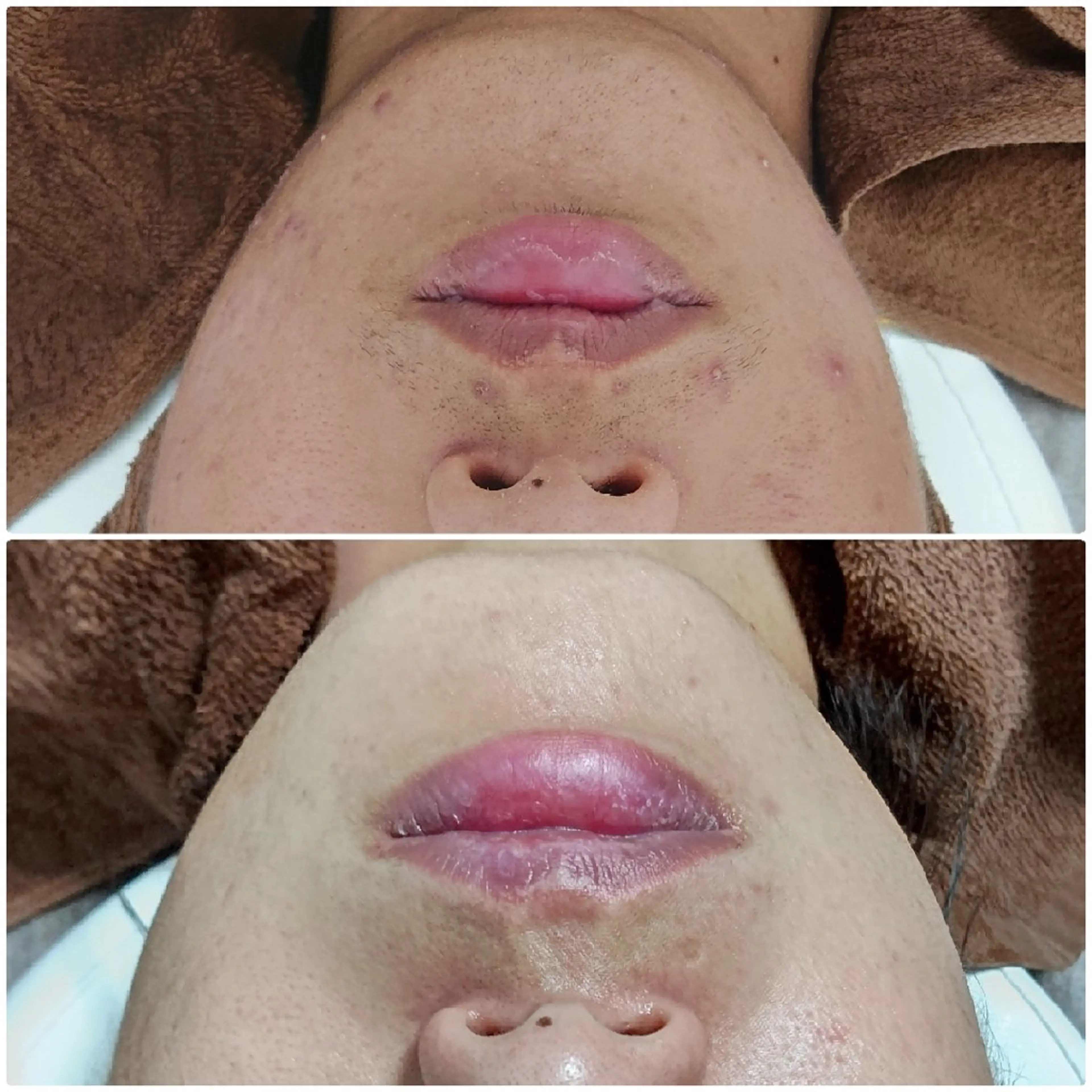 メンズ エステ Iryアイリー所属・Iry アイリーのエステ・リラクイメージ