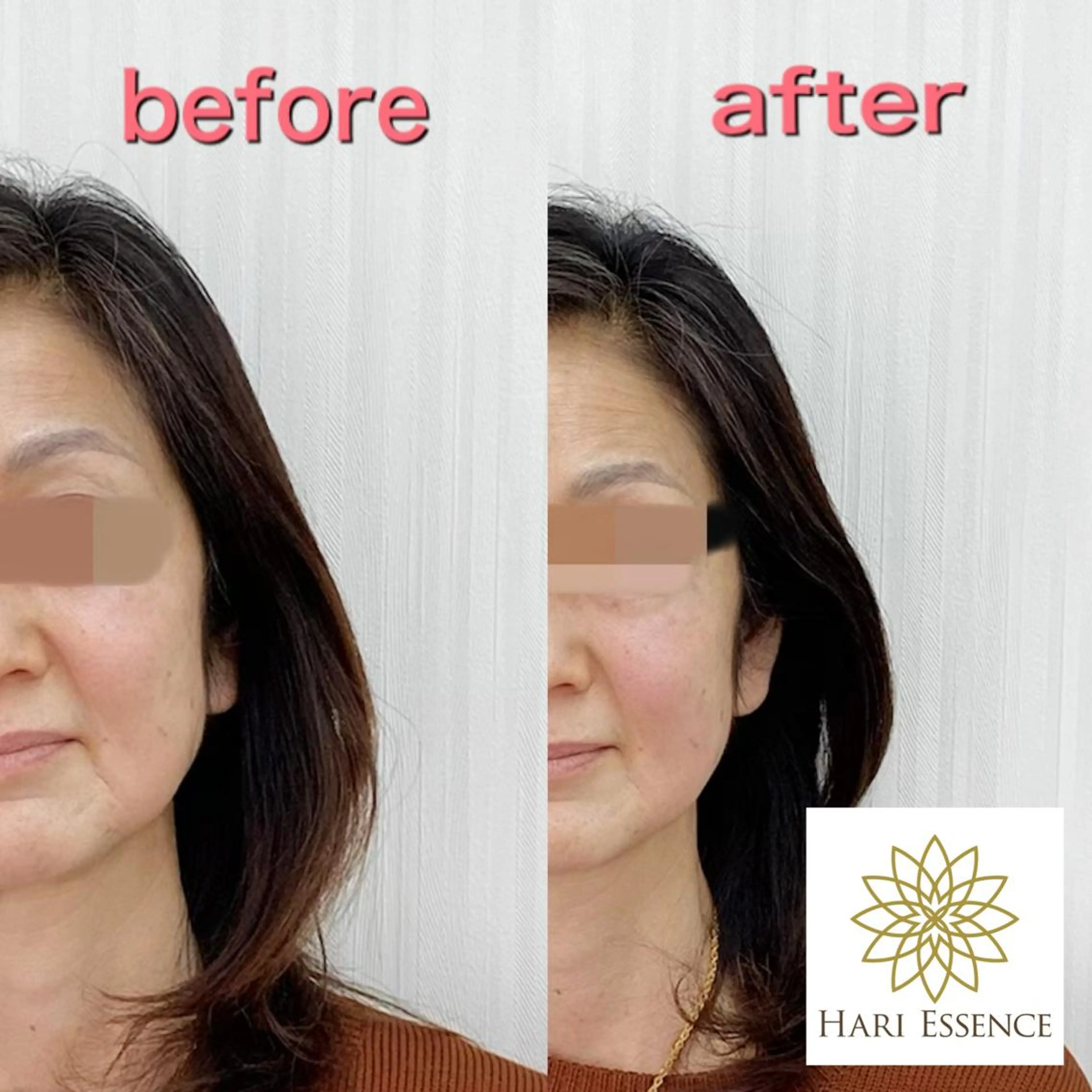 美容鍼専門鍼灸院 ハリエッセンスのその他イメージ