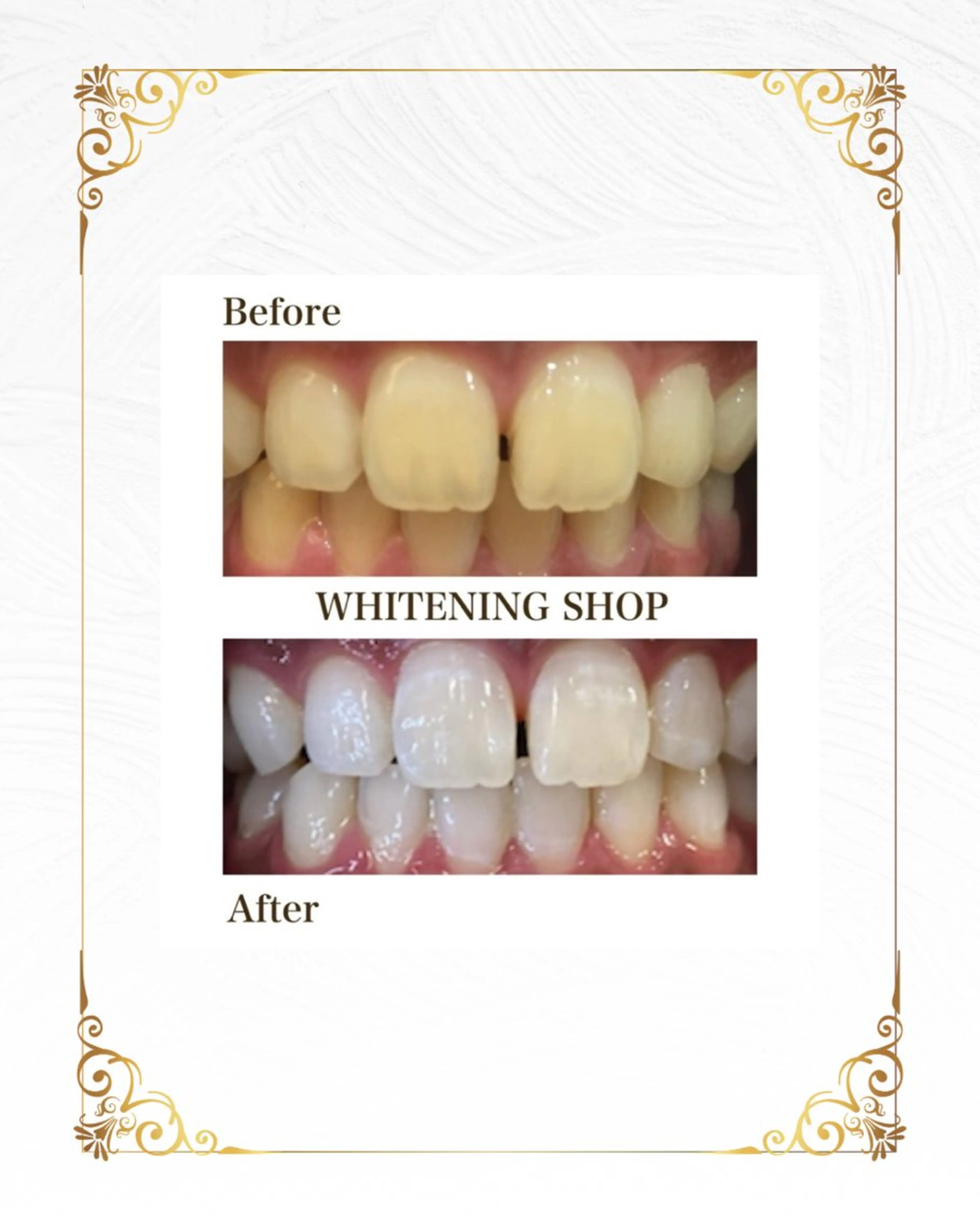 ホワイトニング ショップ葵区静岡駅店のその他イメージ