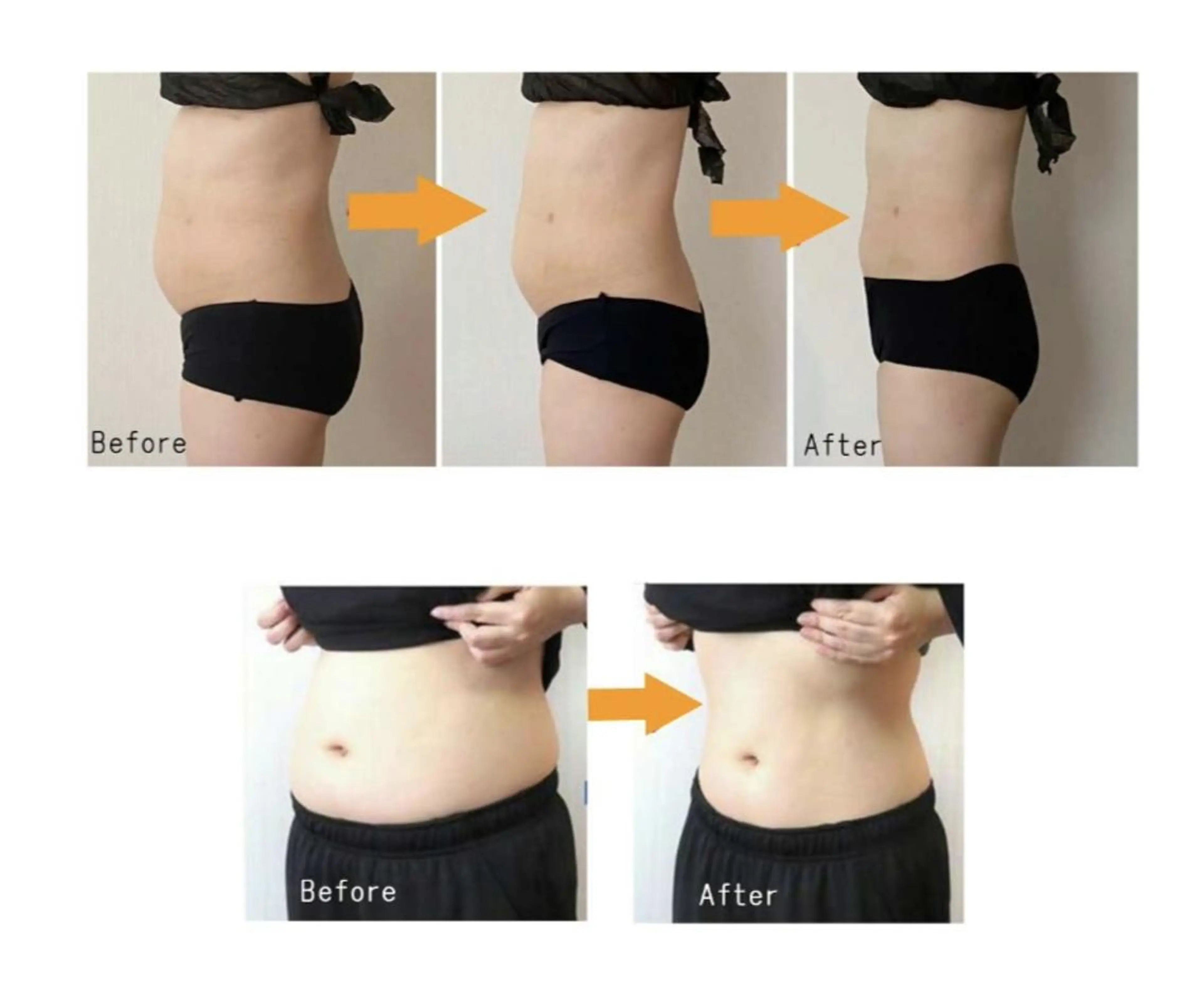 ☆エリア初！TVやSNSで話題の【冷却】痩身♪気になる部位を選んで冷却4cup!リバウンド無し￥15840の写真