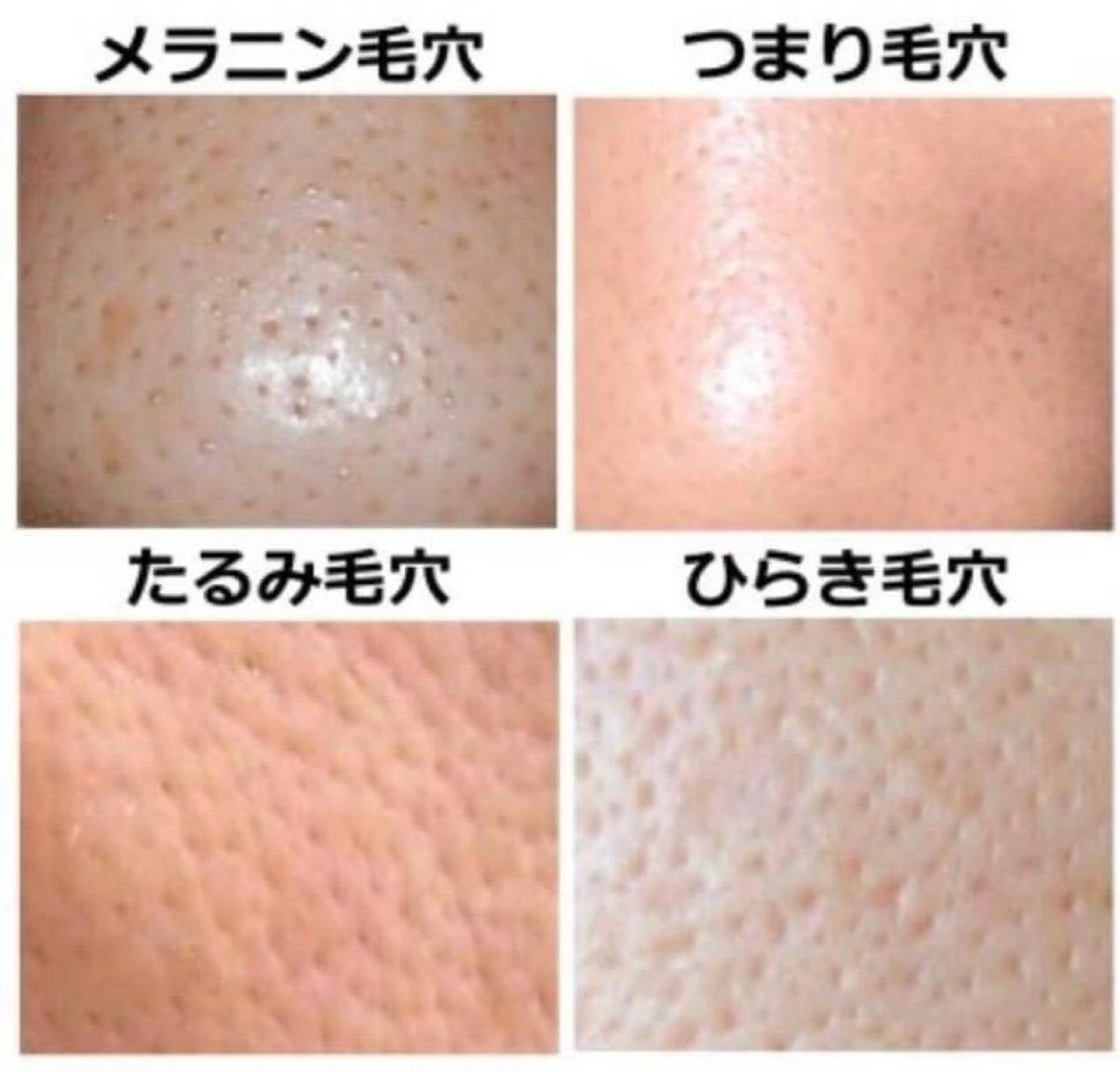 毛穴すっきりコース+メイク体験付きの写真