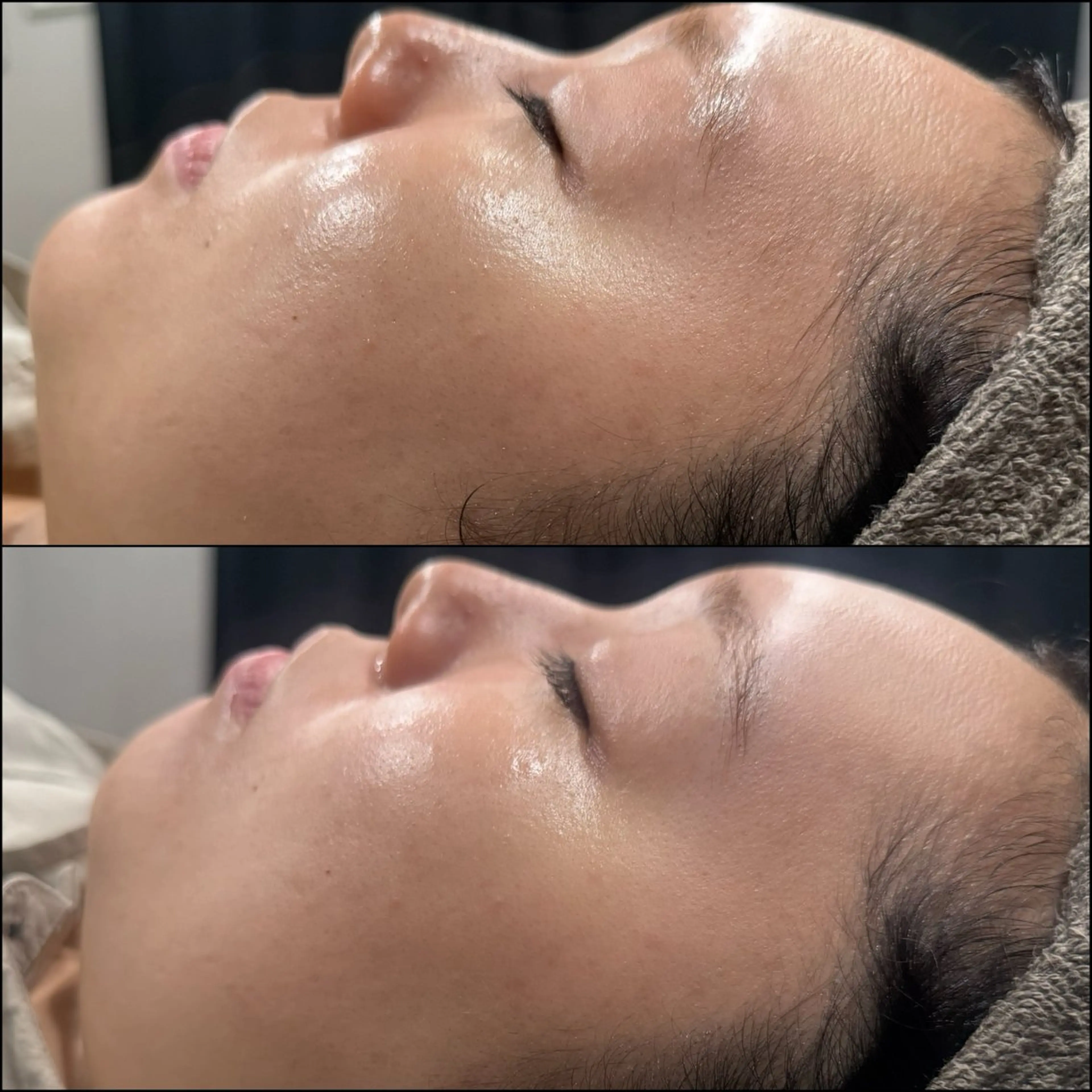 LiZA エステティックサロンのエステ・リラクイメージ