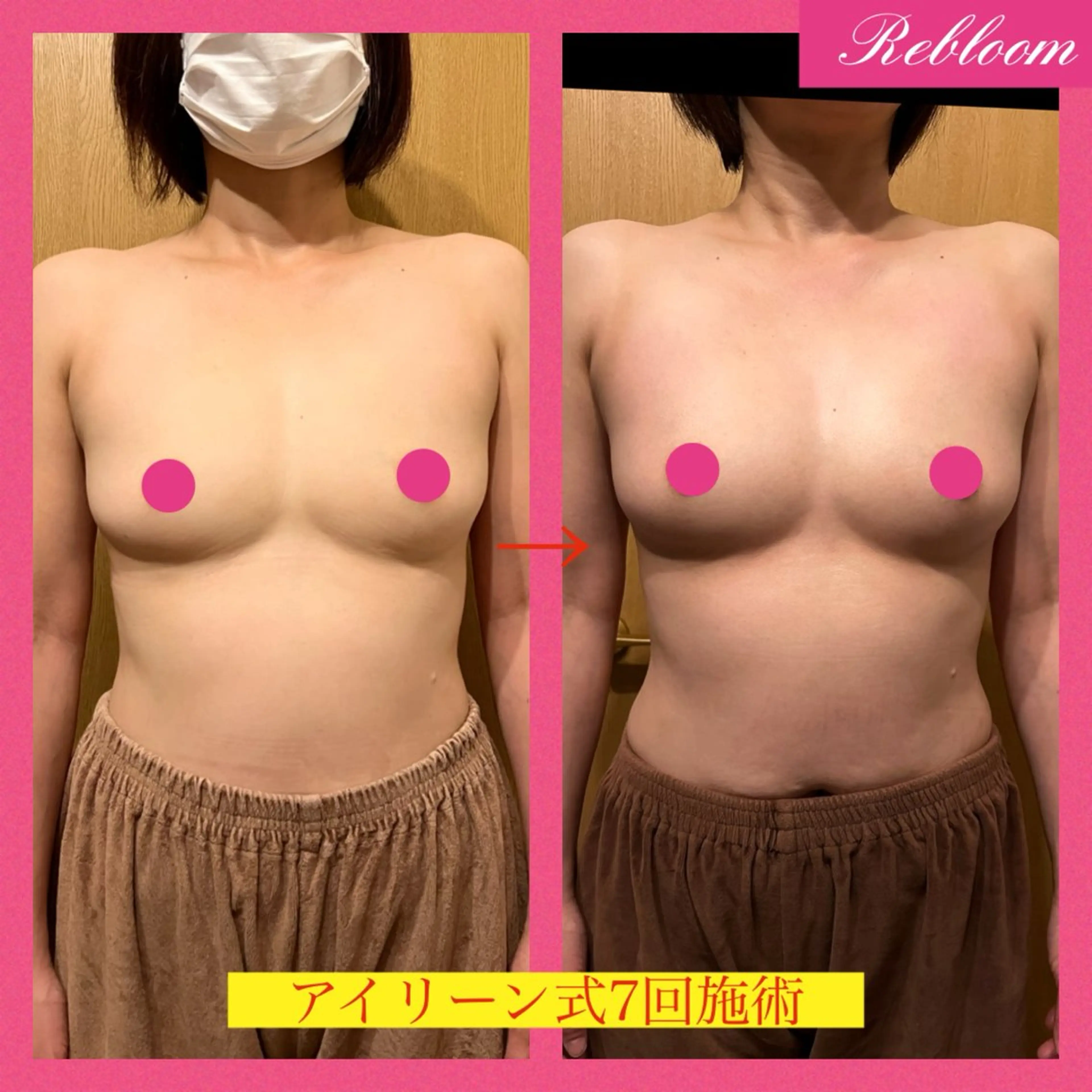 エステ デリケートな悩み解決 Rebloomのエステ・リラクイメージ