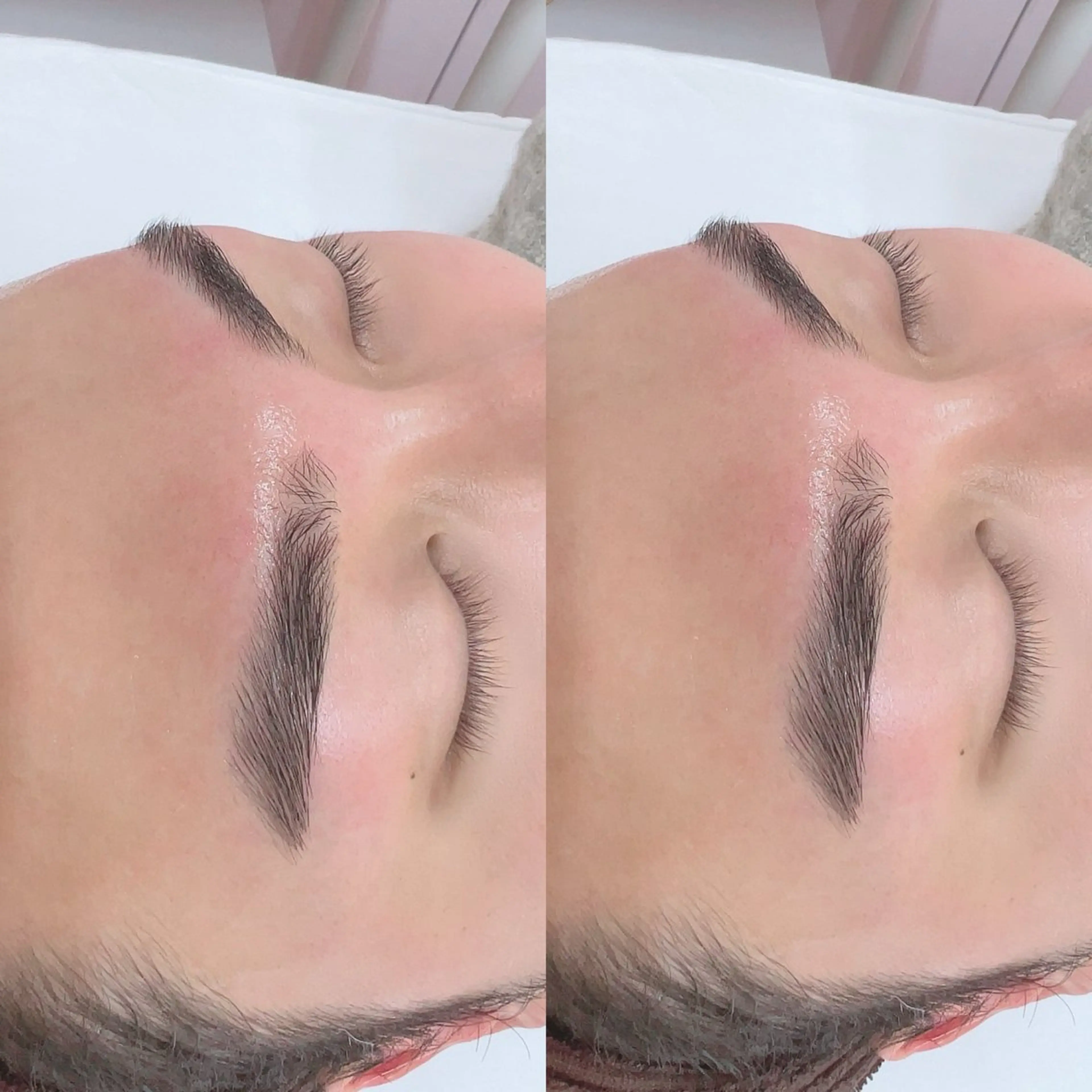 メンズ眉ワックス脱毛の写真