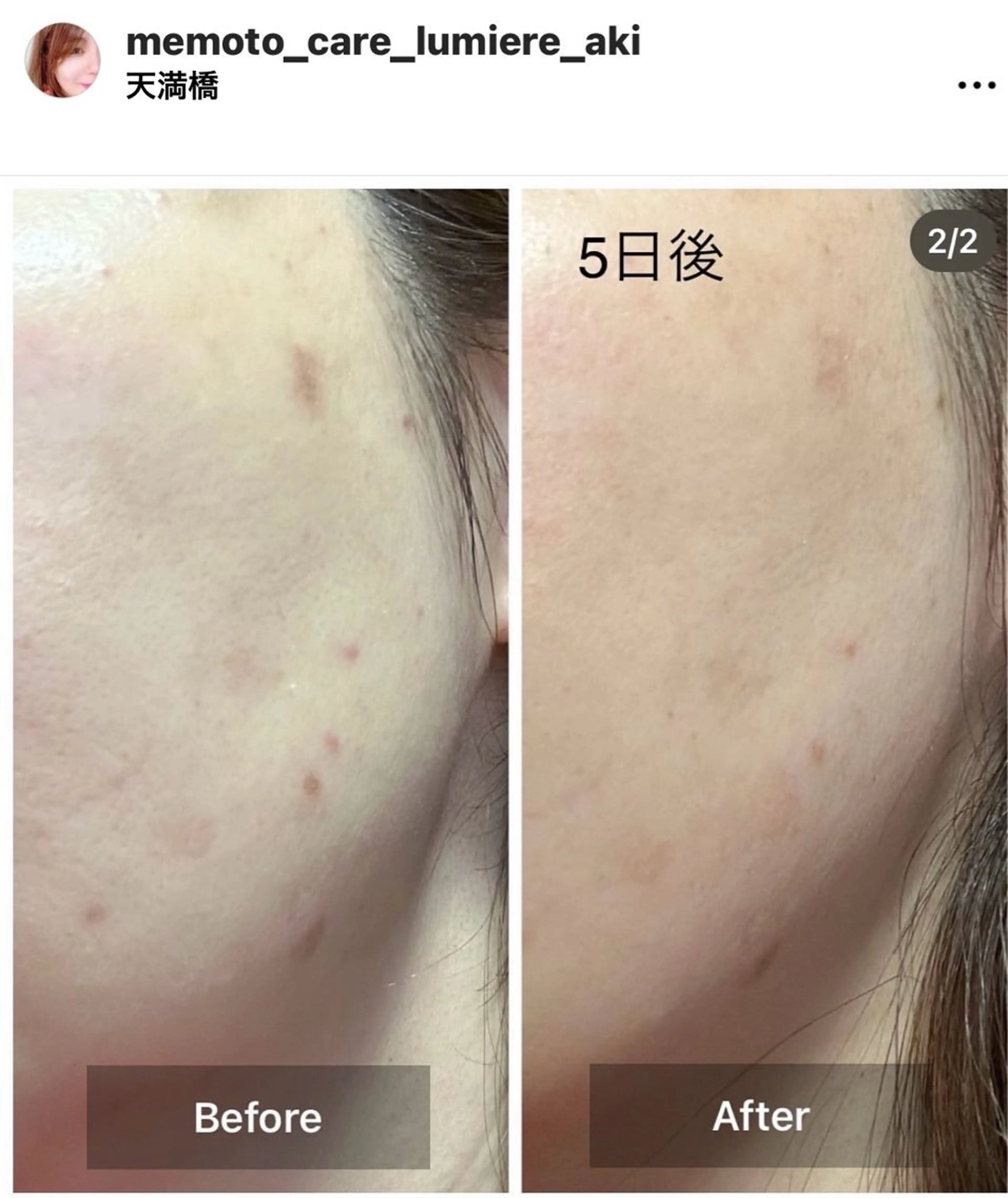 エステ 目元・まつパ・美肌フ ェイシャル谷町四丁目のマツエク・マツパデザイン