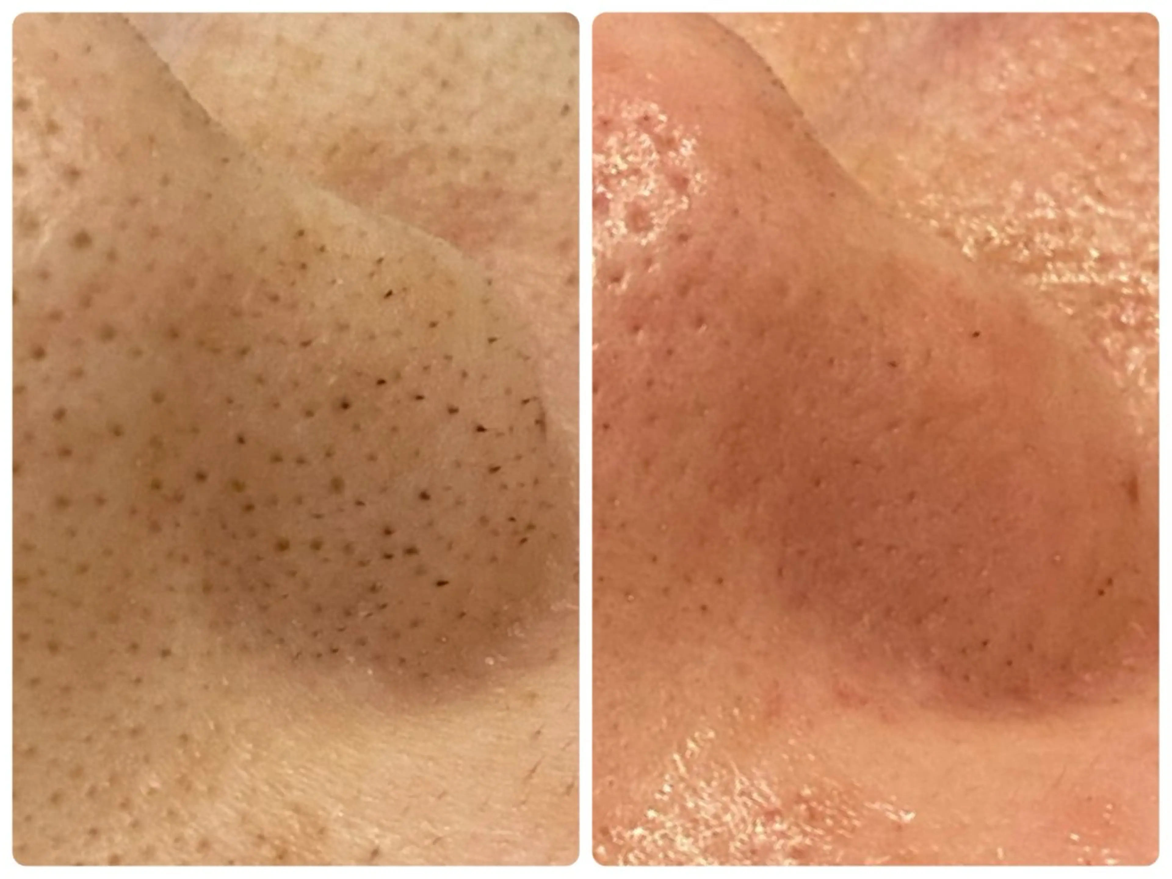 Hisui 小出のエステ・リラクイメージ