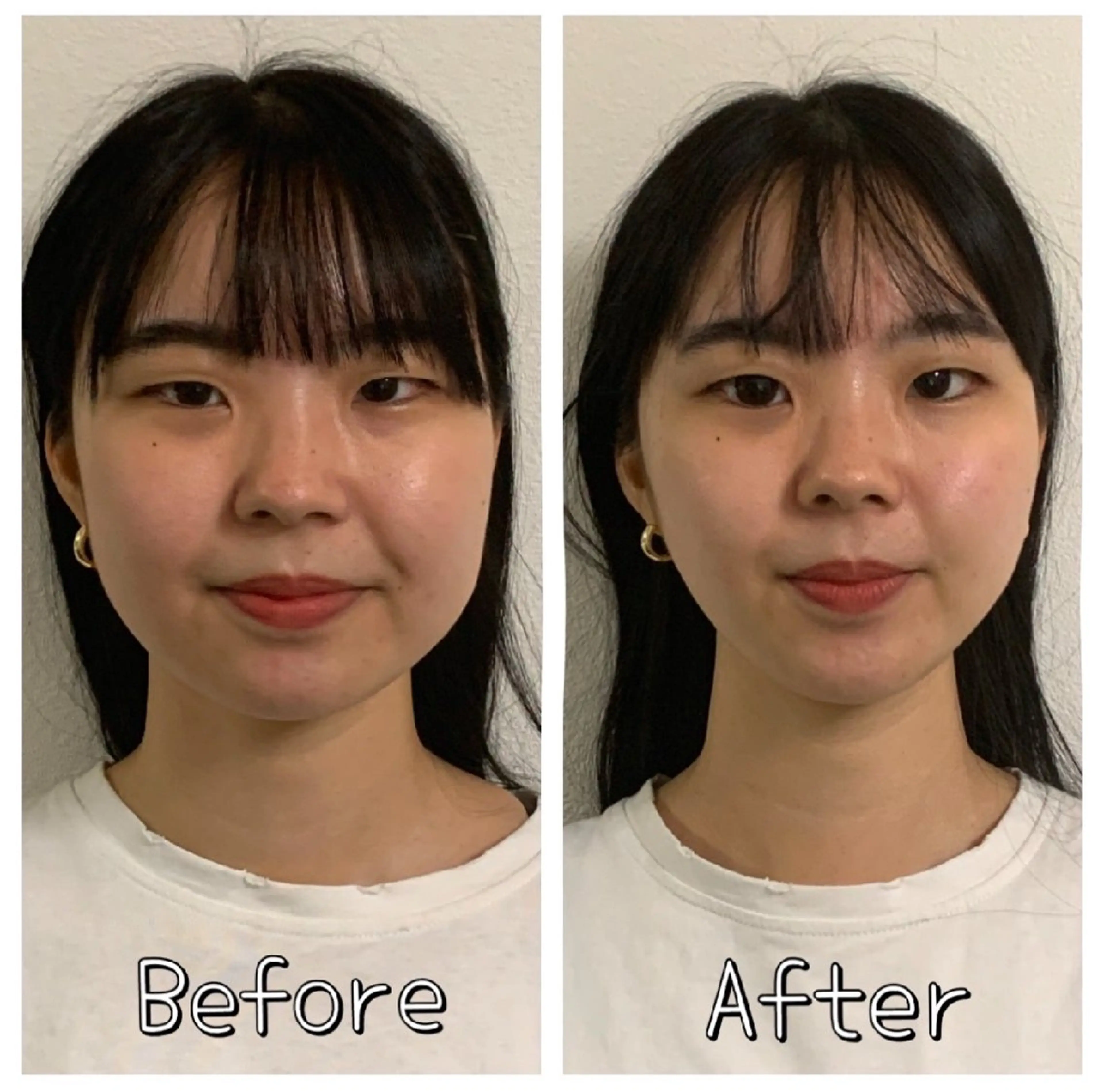 医療提携サロン新宿 La Lunaのエステ・リラクイメージ