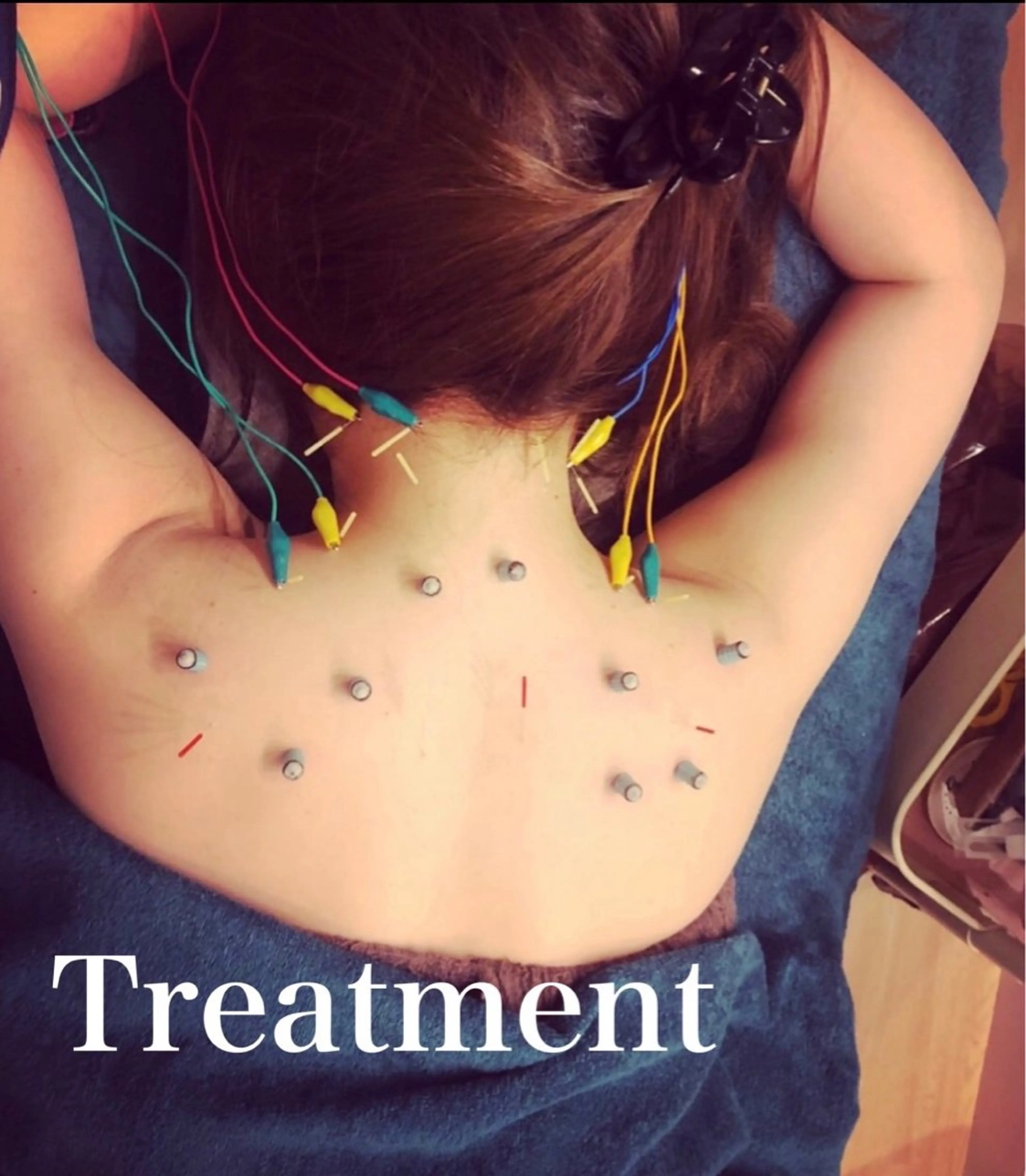 鍼灸サロン mahorobaトモのエステ・リラクイメージ