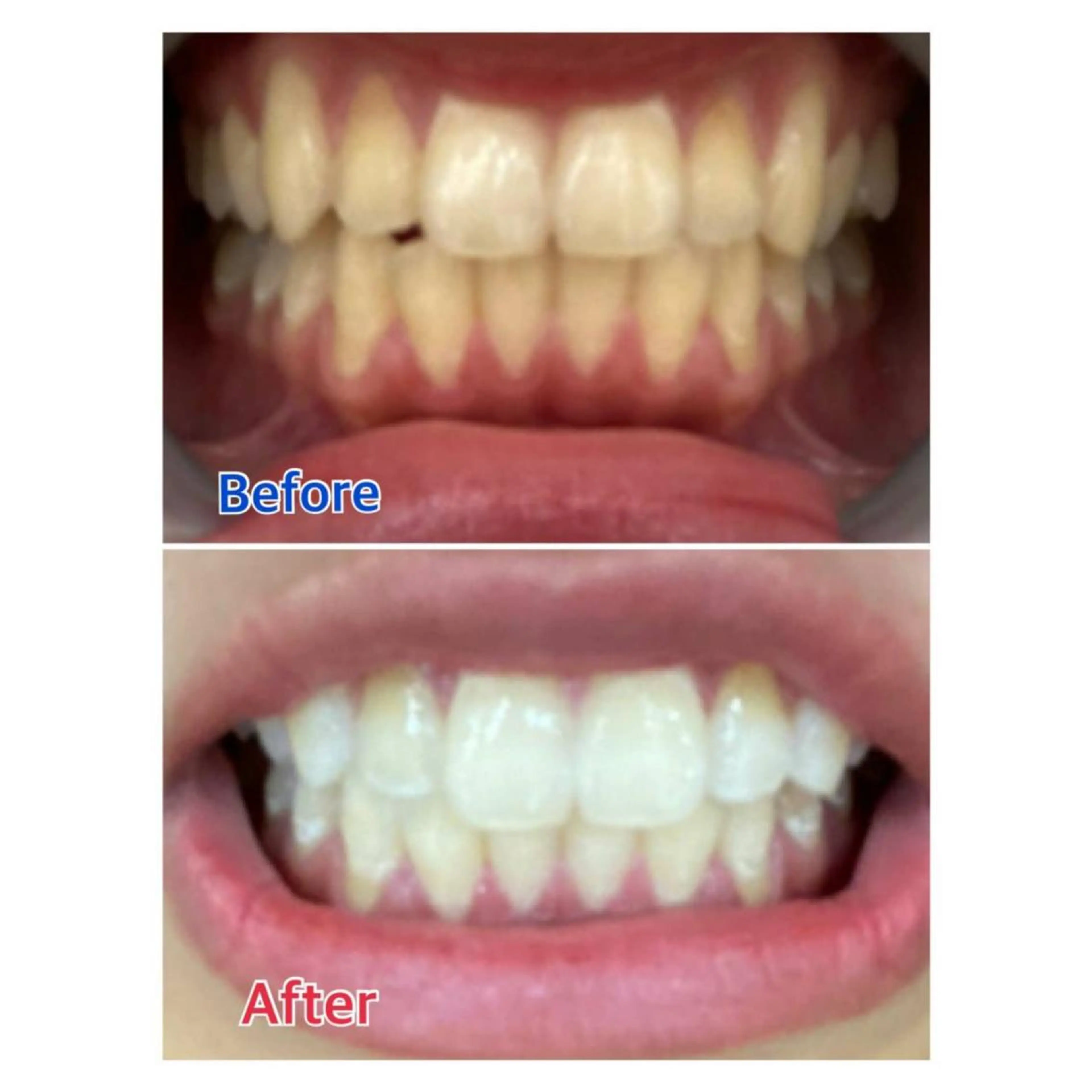 MBEAUTYSALON 千葉店・京成大久保所属・Melty 輝のその他イメージ