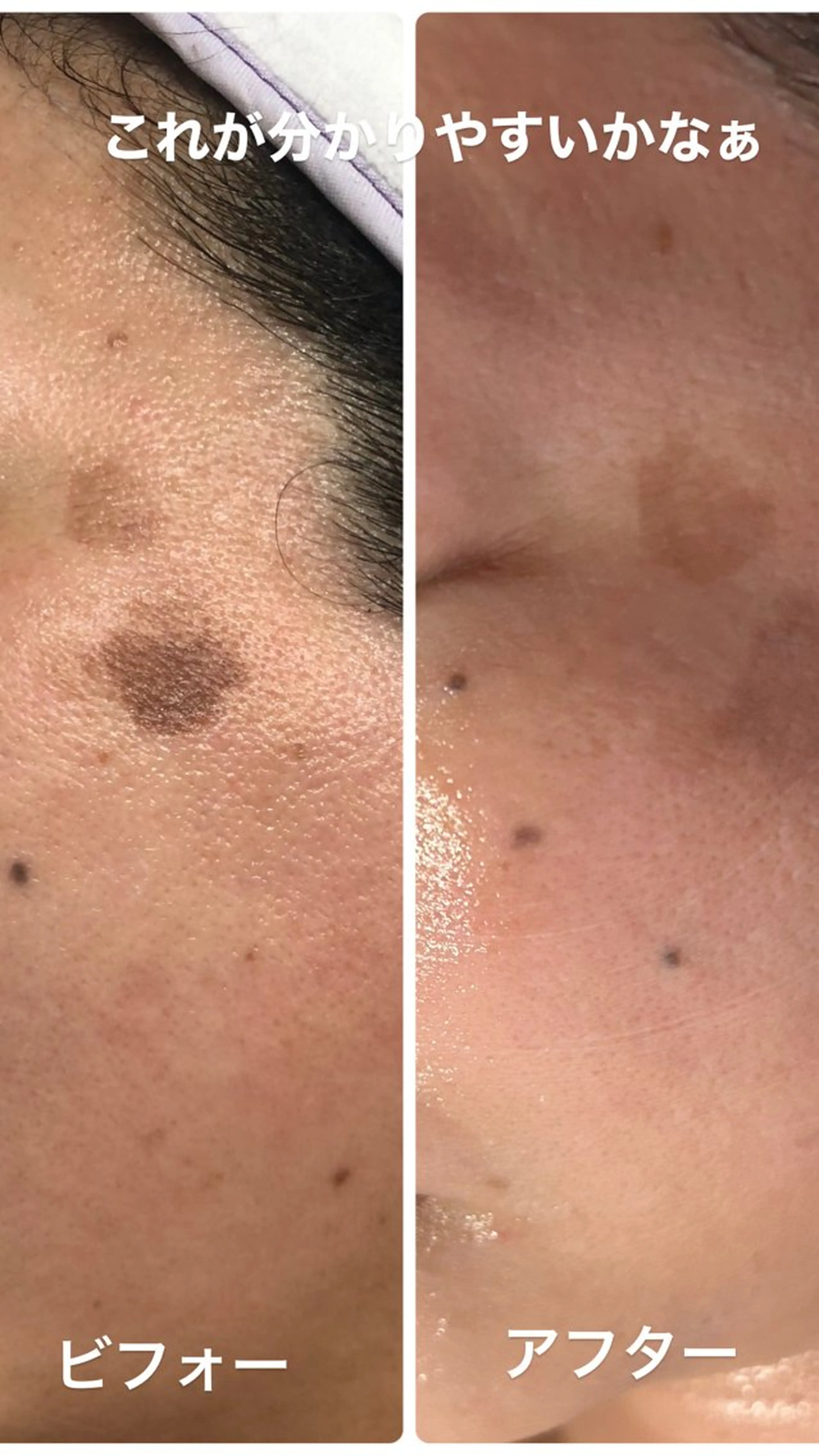 美肌脱毛fuu okinawa所属・宜野湾美肌脱毛fuu okinawaタイラのエステ・リラクイメージ