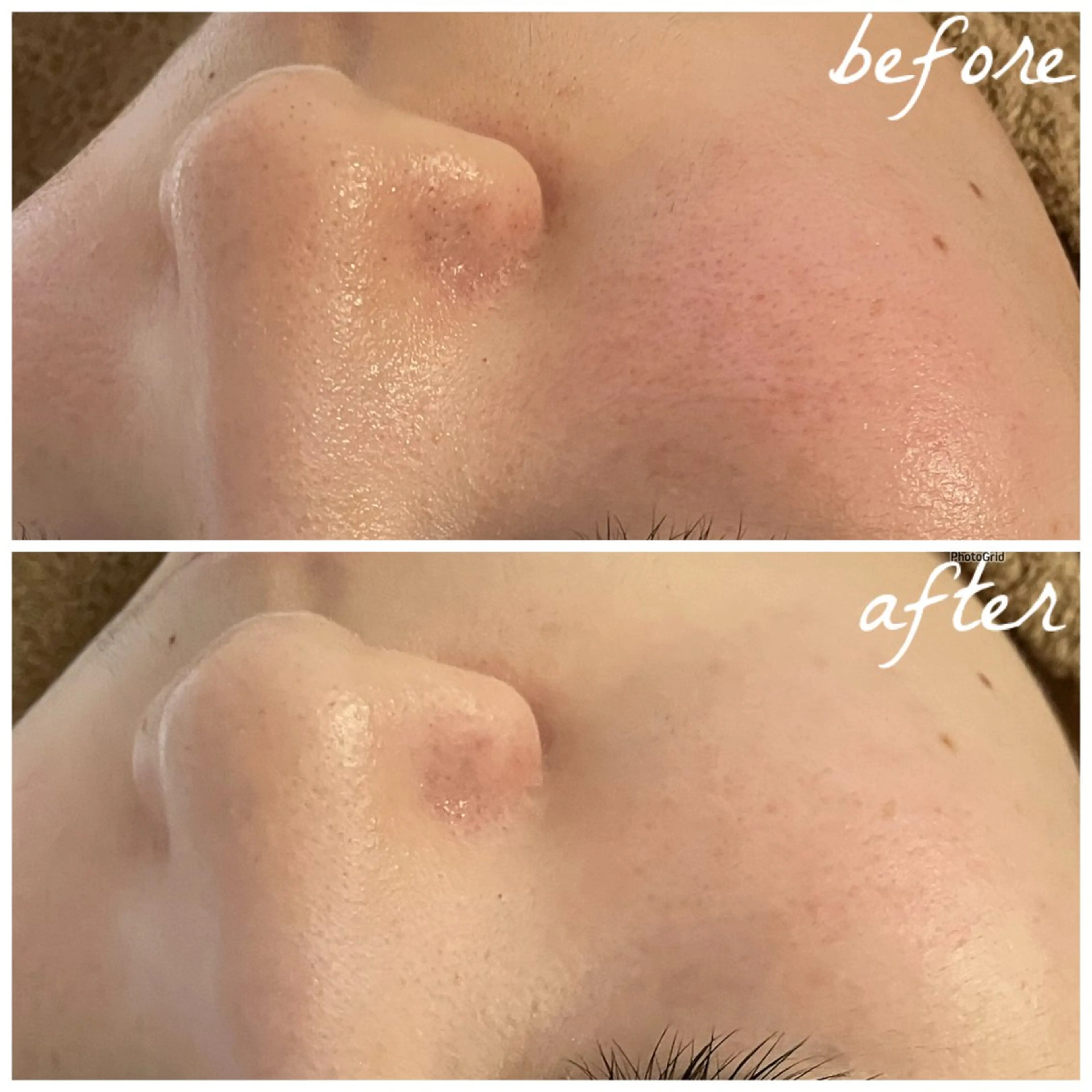 メンズ エステ メナード岐阜茜部 杉浦のエステ・リラクイメージ