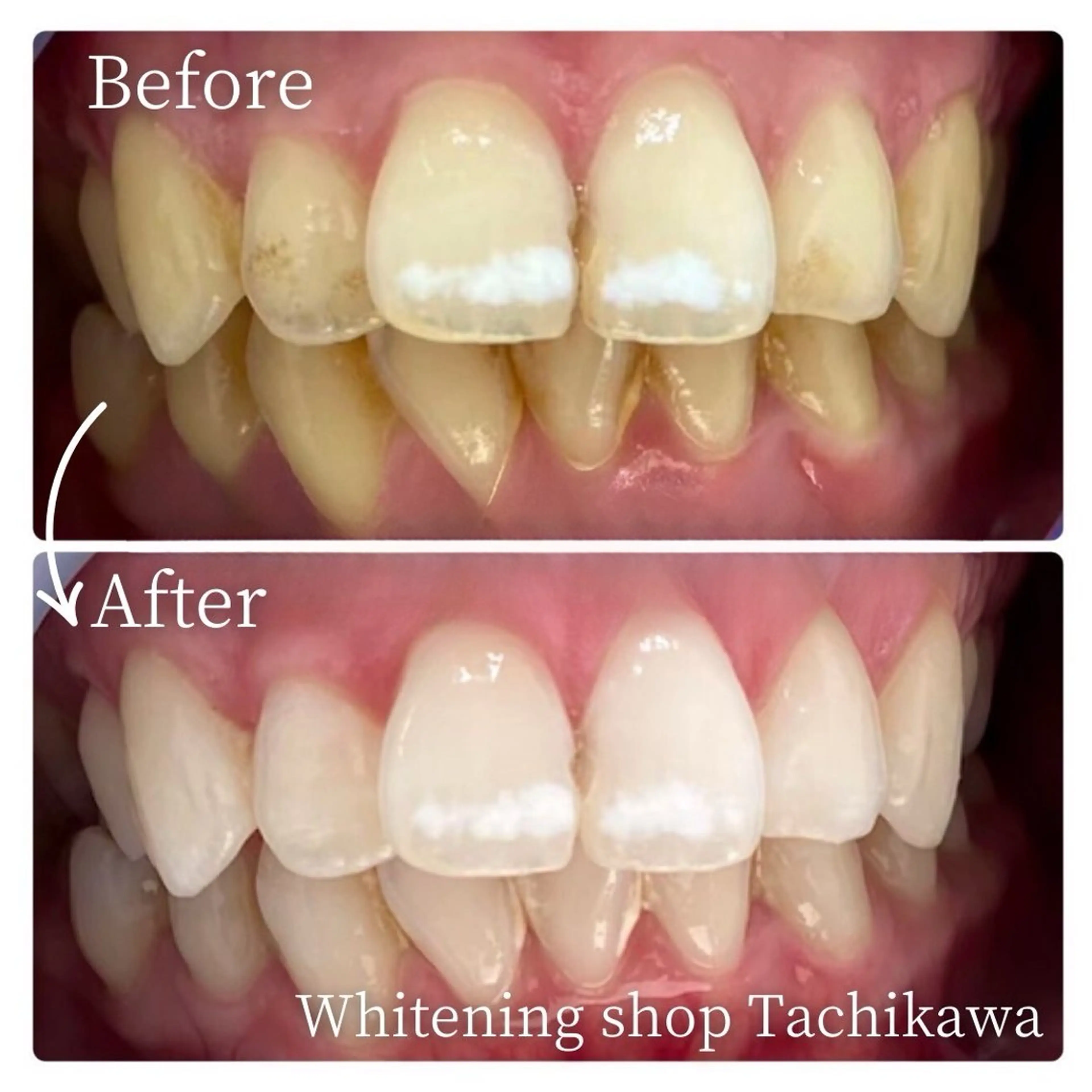 セルフ ホワイト ニングショップ立川のその他イメージ