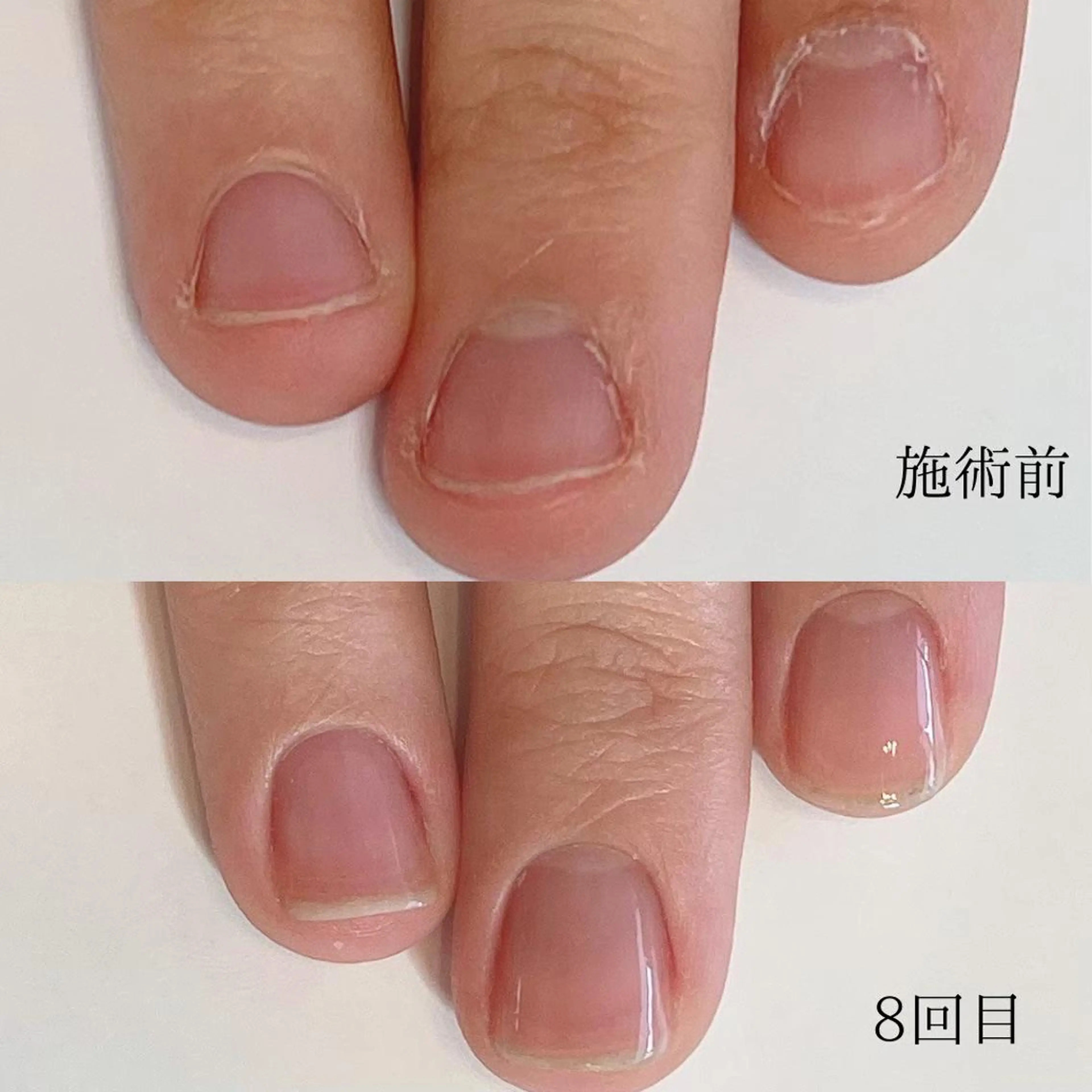 その他(ネイル) 木村 千晴のネイルデザイン