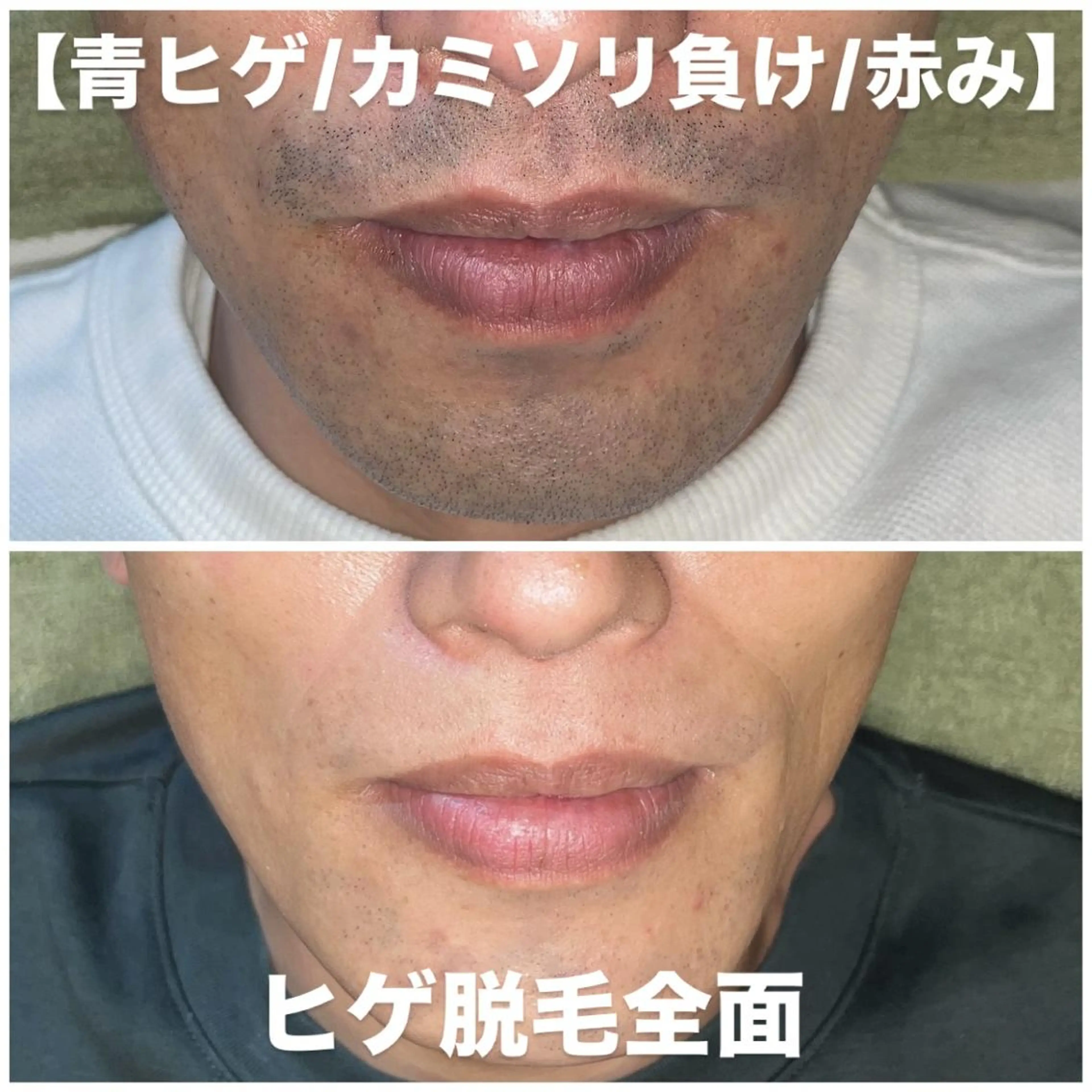 メンズ 脱毛 ビューティーサロン リノアのエステ・リラクイメージ