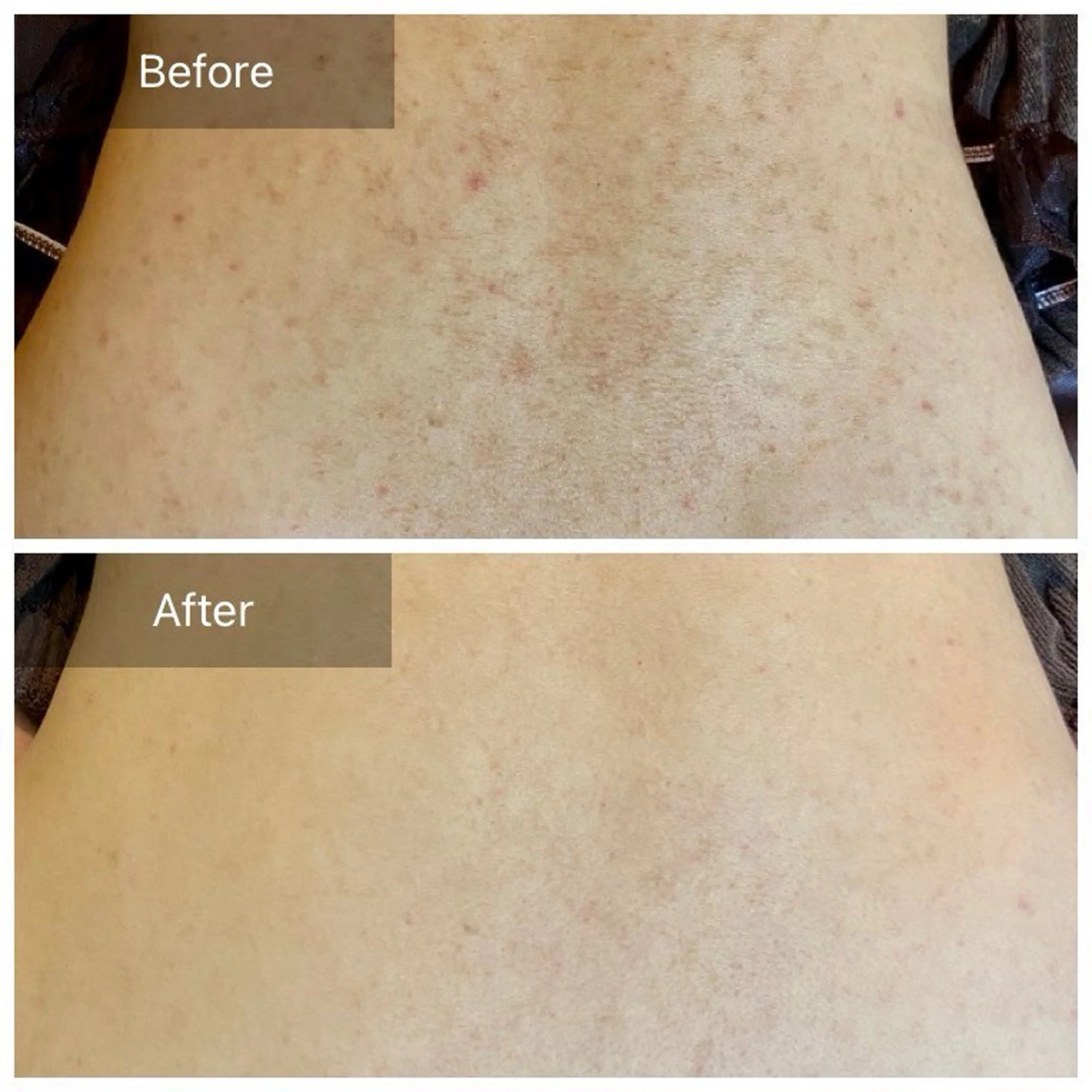 Flourb所属・ハーブピーリング専門 サロンFlourbのエステ・リラクイメージ