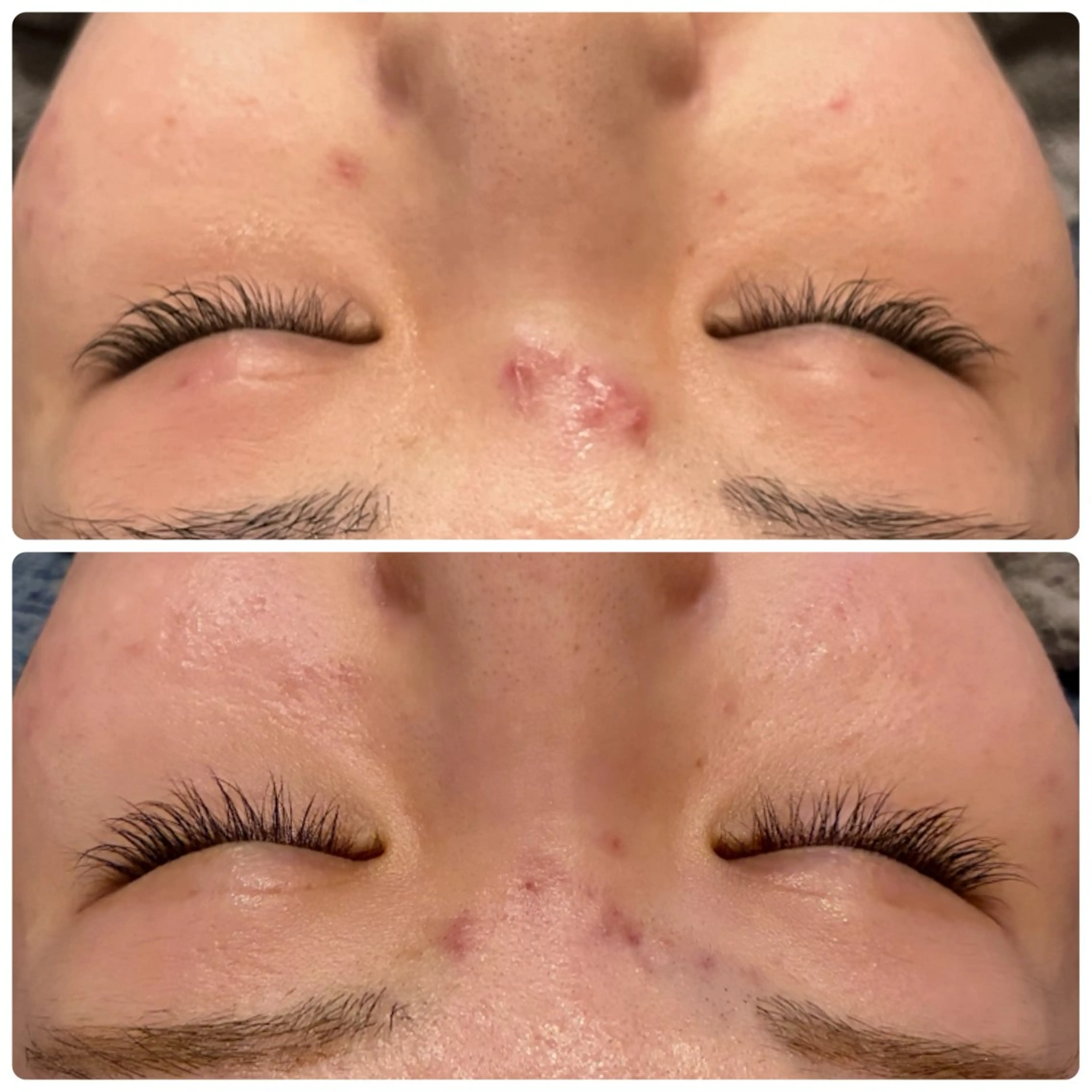 脱毛 yellow💛【 脱毛&フェイシャル】のエステ・リラクイメージ