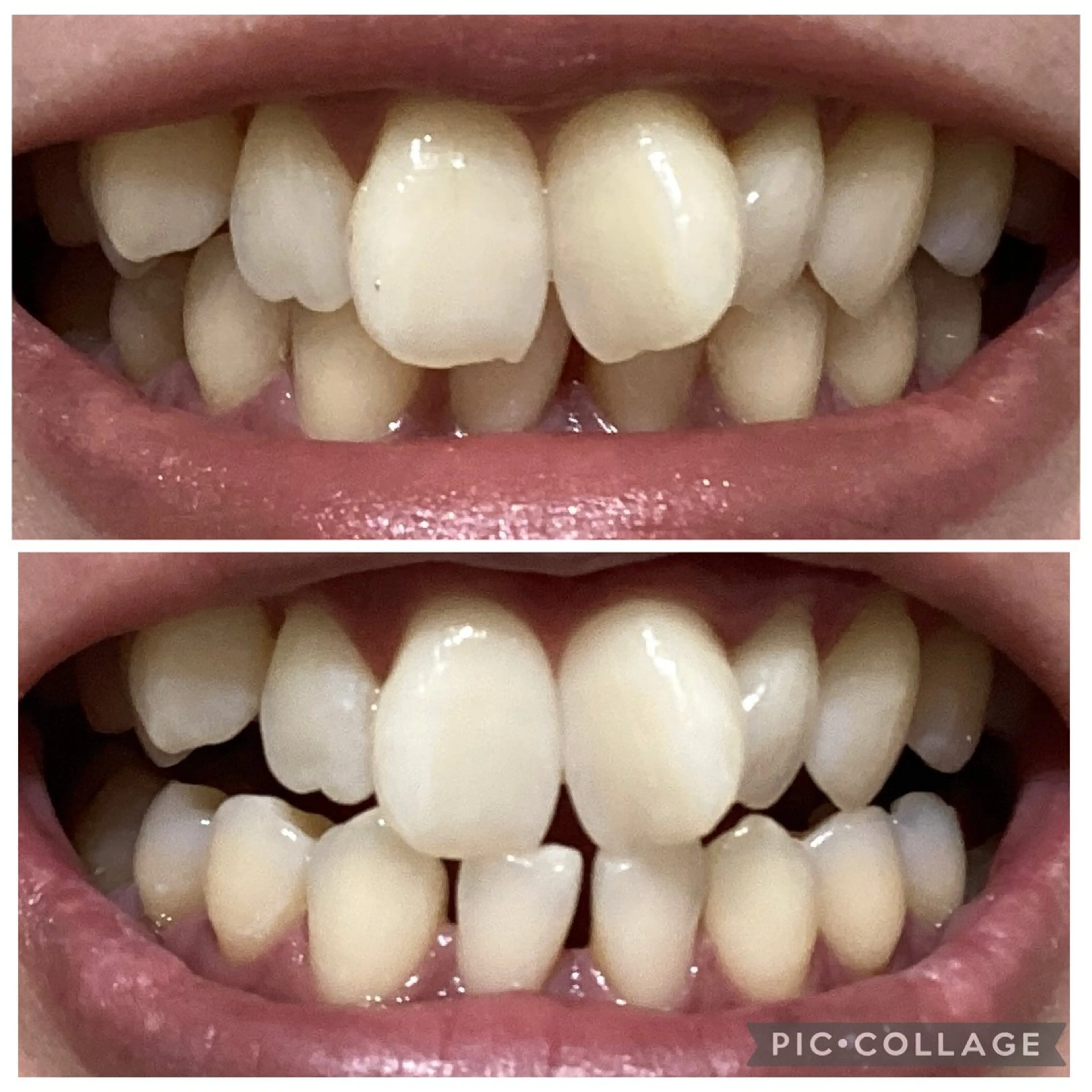 セルフホワイトニングサロン　Betee所属・セルフホワイトニング Beteeのエステ・リラクイメージ