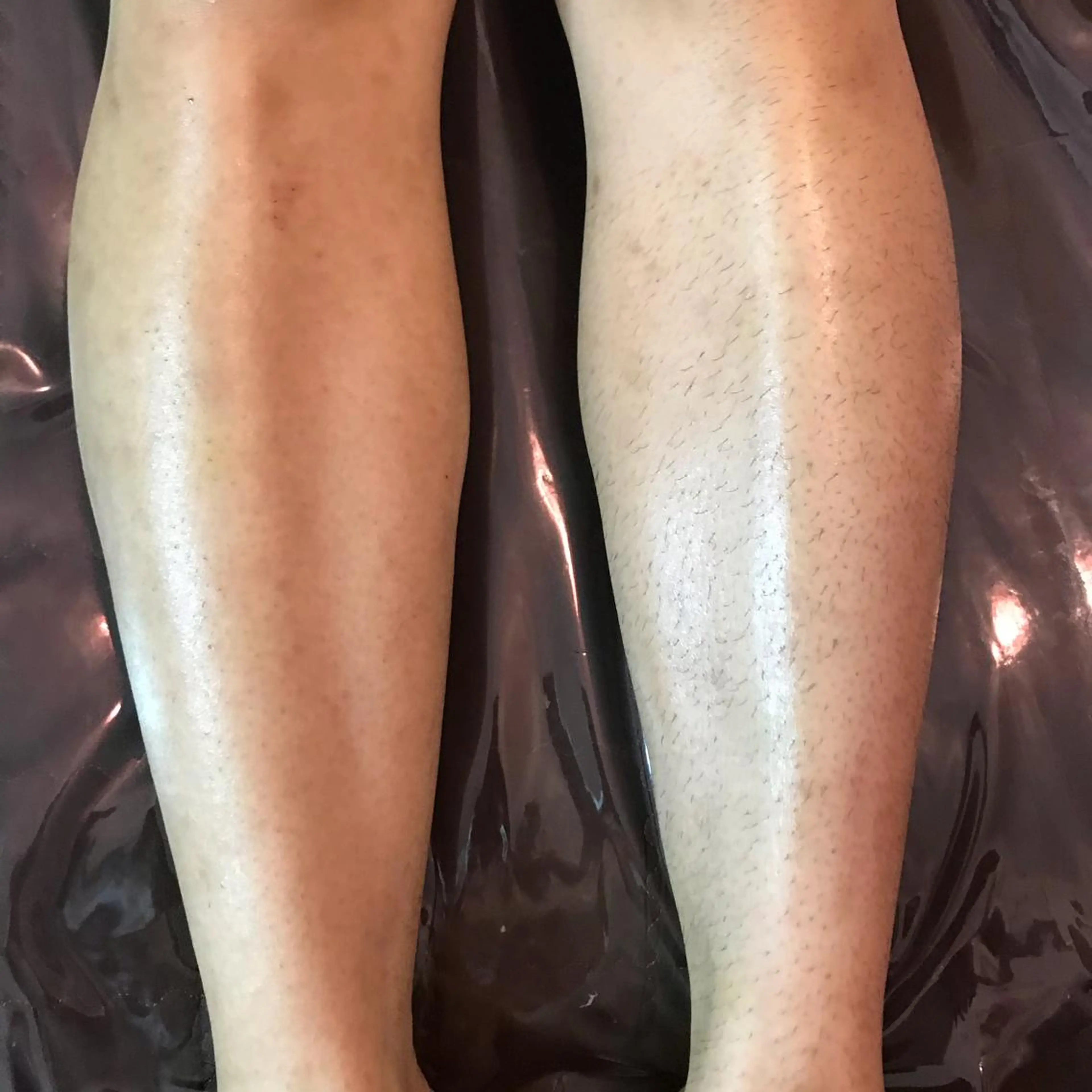 代表 MOMOのエステ・リラクイメージ