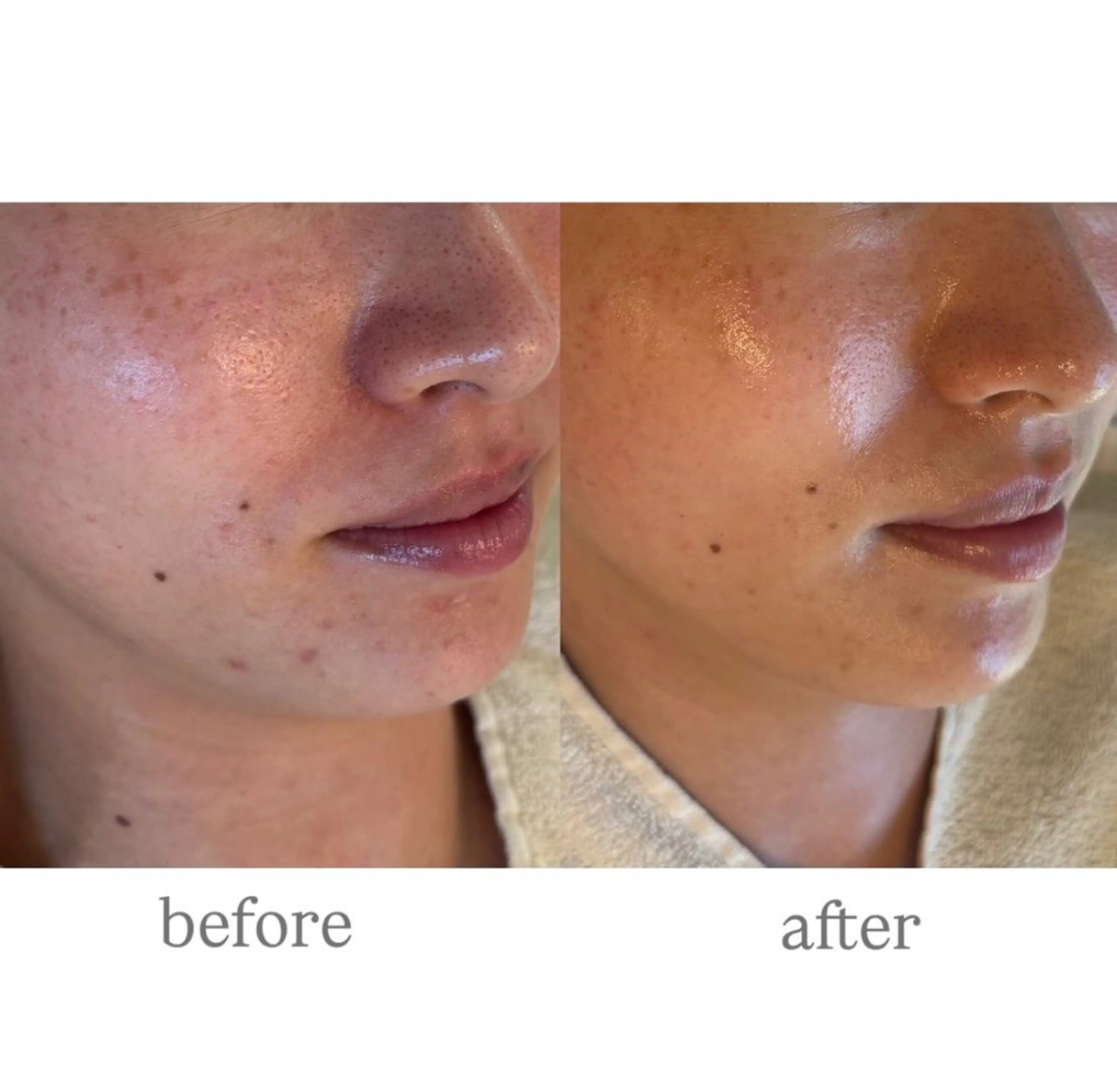 エステ anthes /MIHOのエステ・リラクイメージ