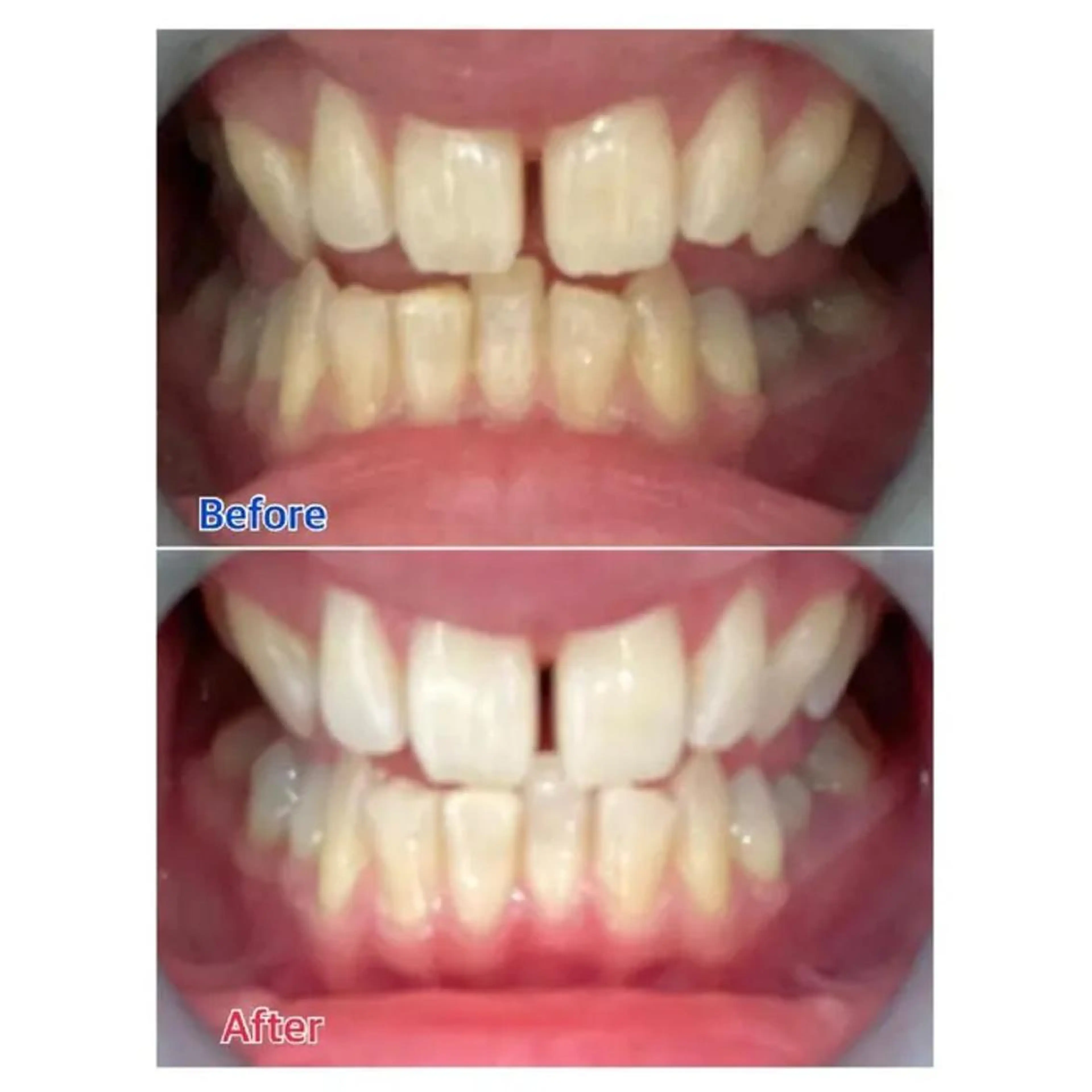 M渋谷 ホワイトニングのエステ・リラクイメージ