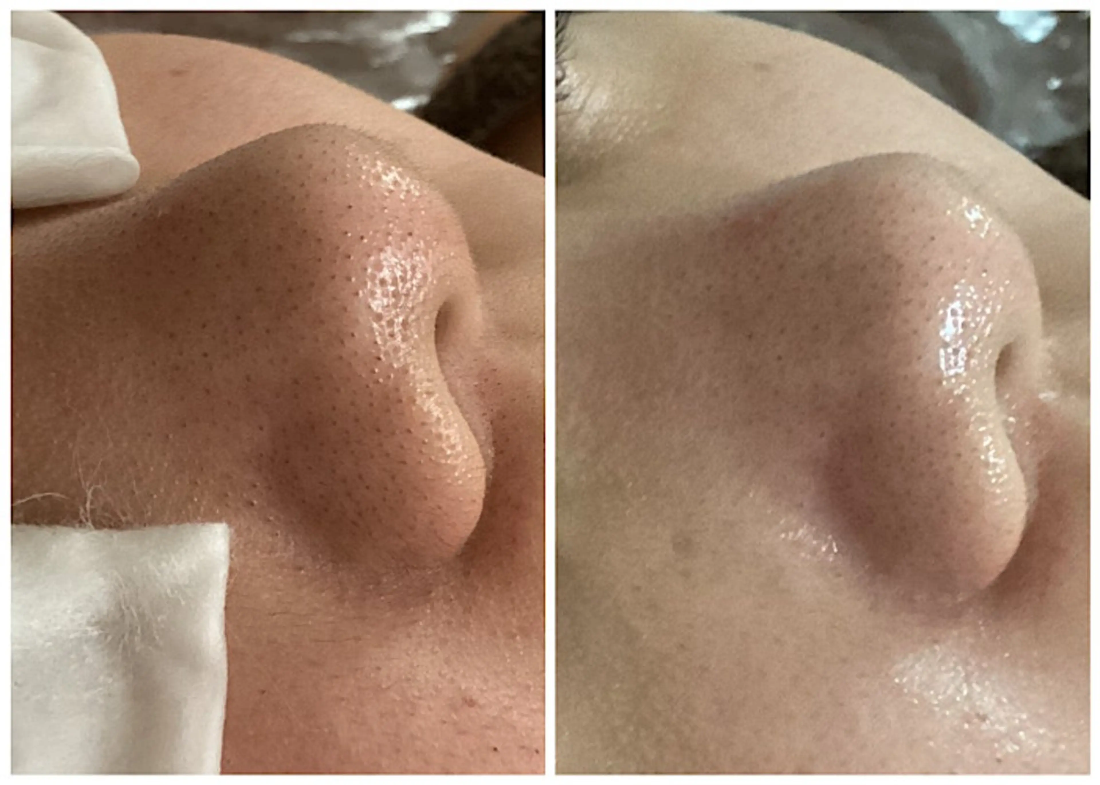 ize 横浜店のエステ・リラクイメージ