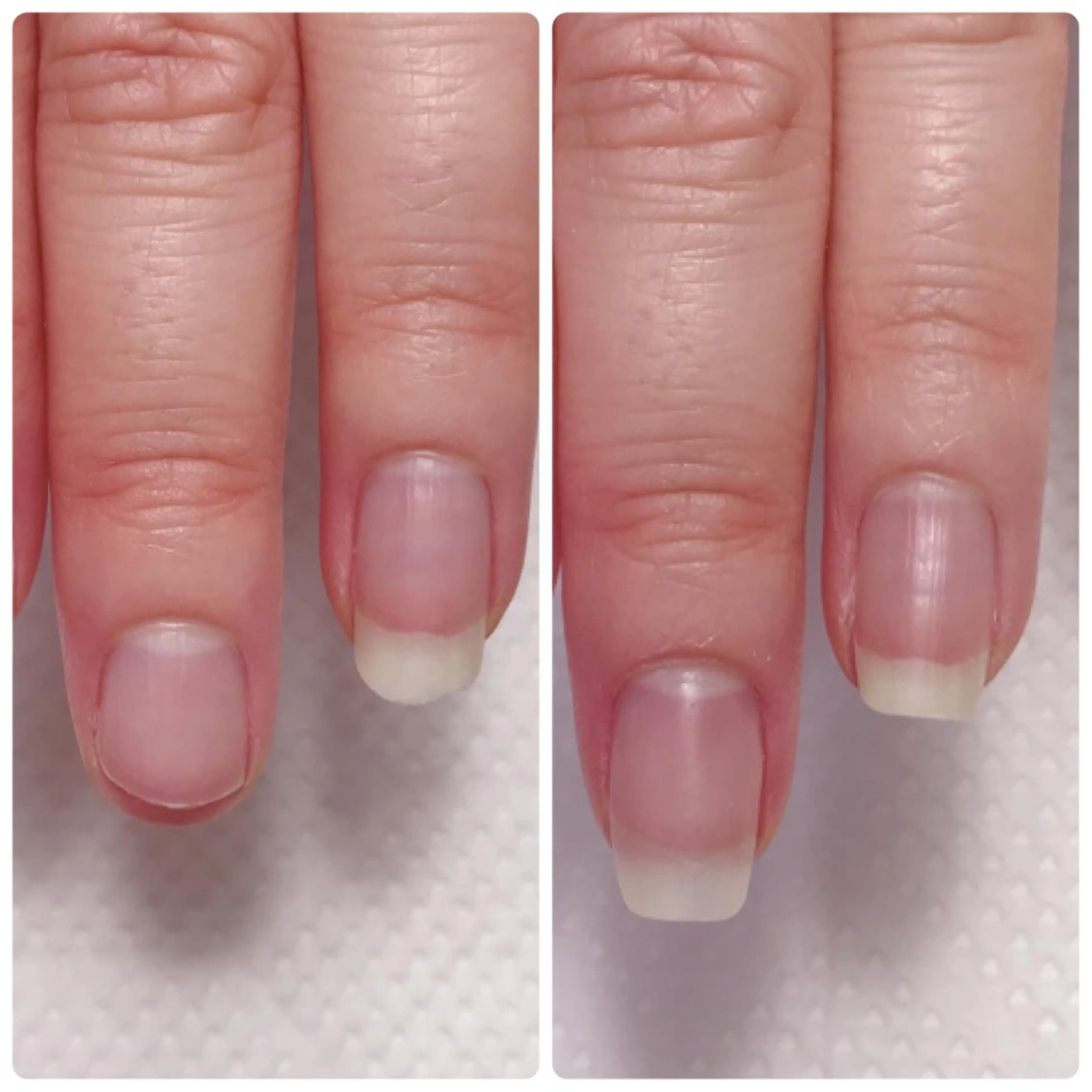 ネイル ハンドネイル 深爪を断らない スカルプ高評価店のネイルデザイン