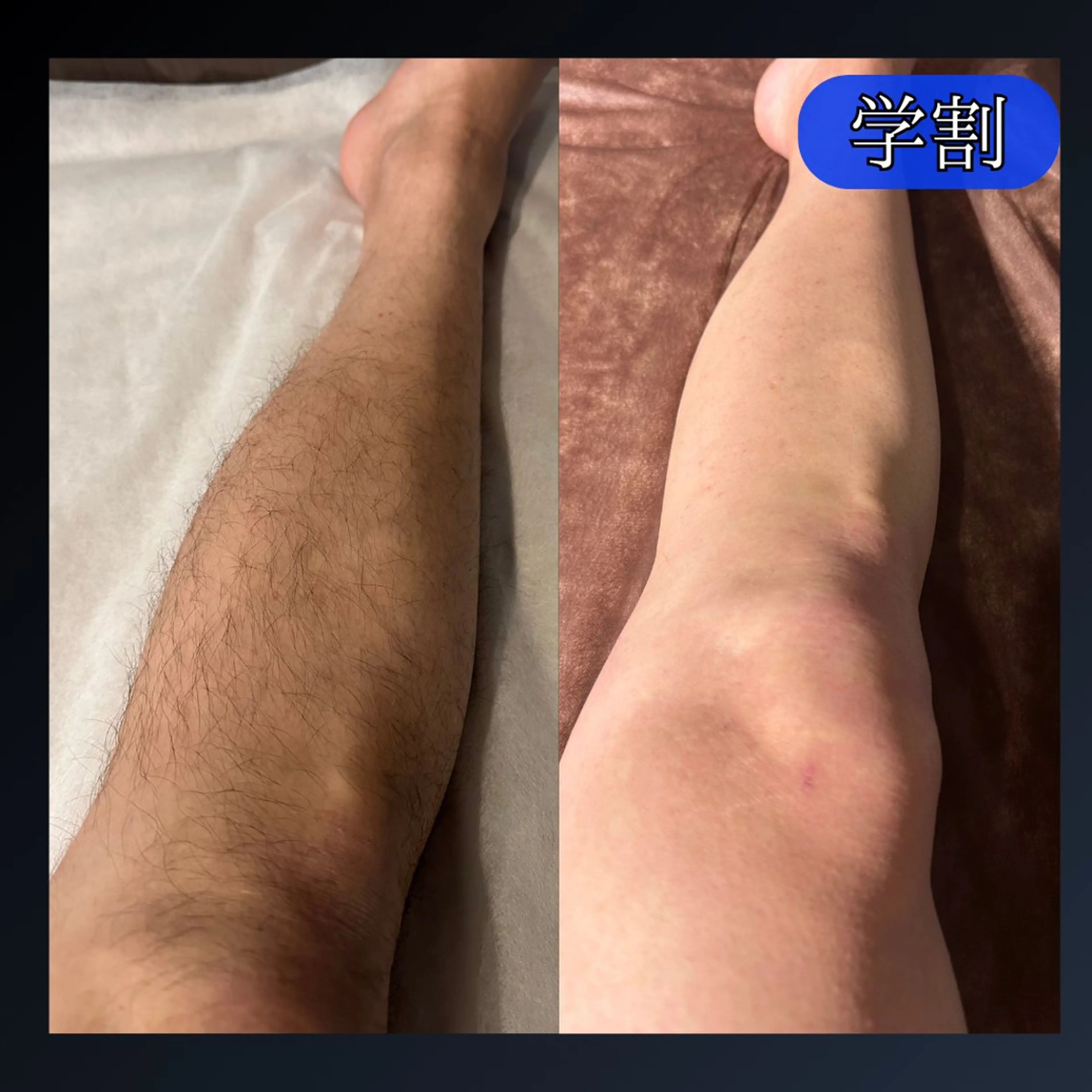 メンズ 脱毛＆眉毛サロン メンズ専用Grastの眉毛・アイブロウイメージ