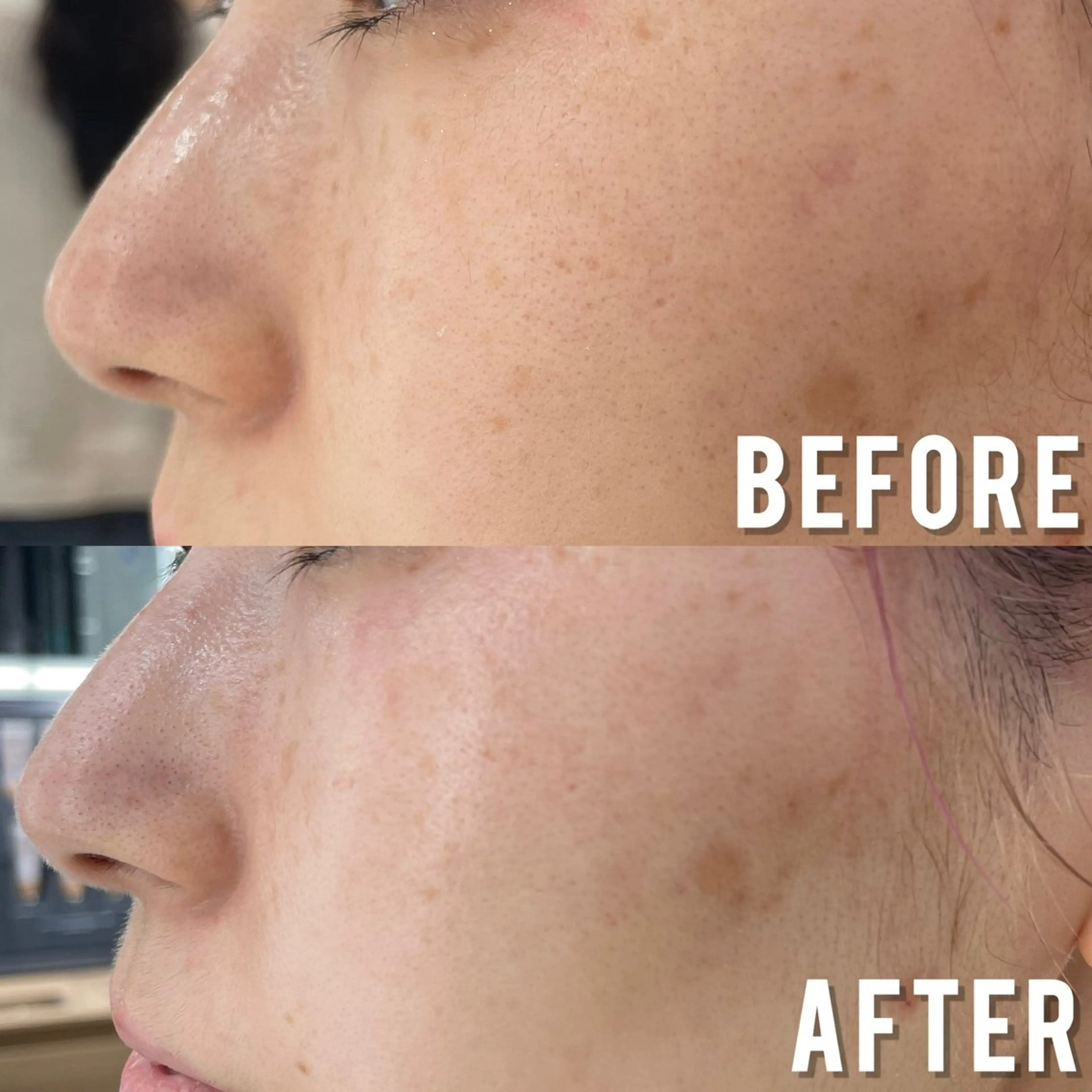 エステ 小顔、毛穴ケア 通い放題エステのエステ・リラクイメージ