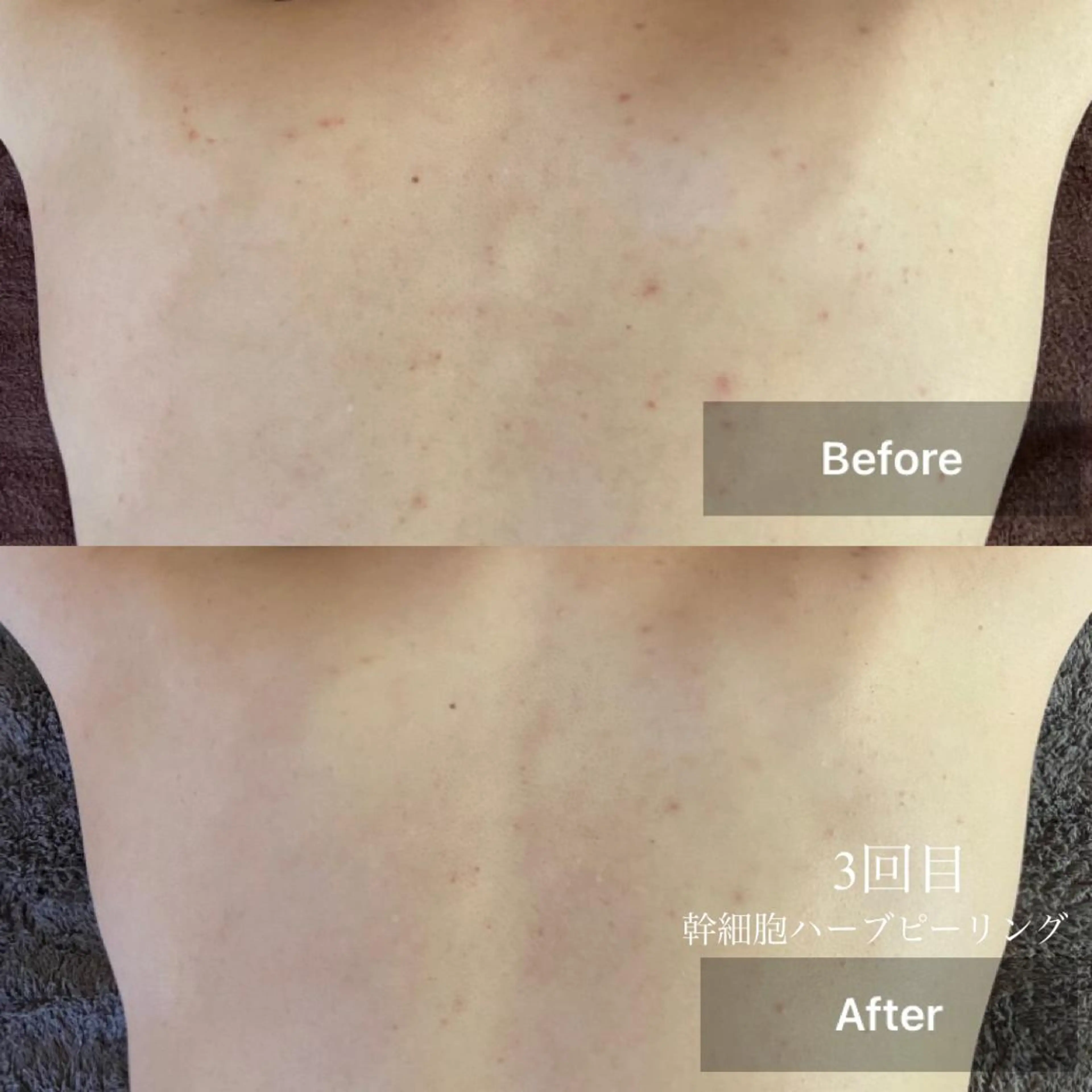 メンズ キッズ エステ 美肌と癒しのサロン Lu,Mieのエステ・リラクイメージ