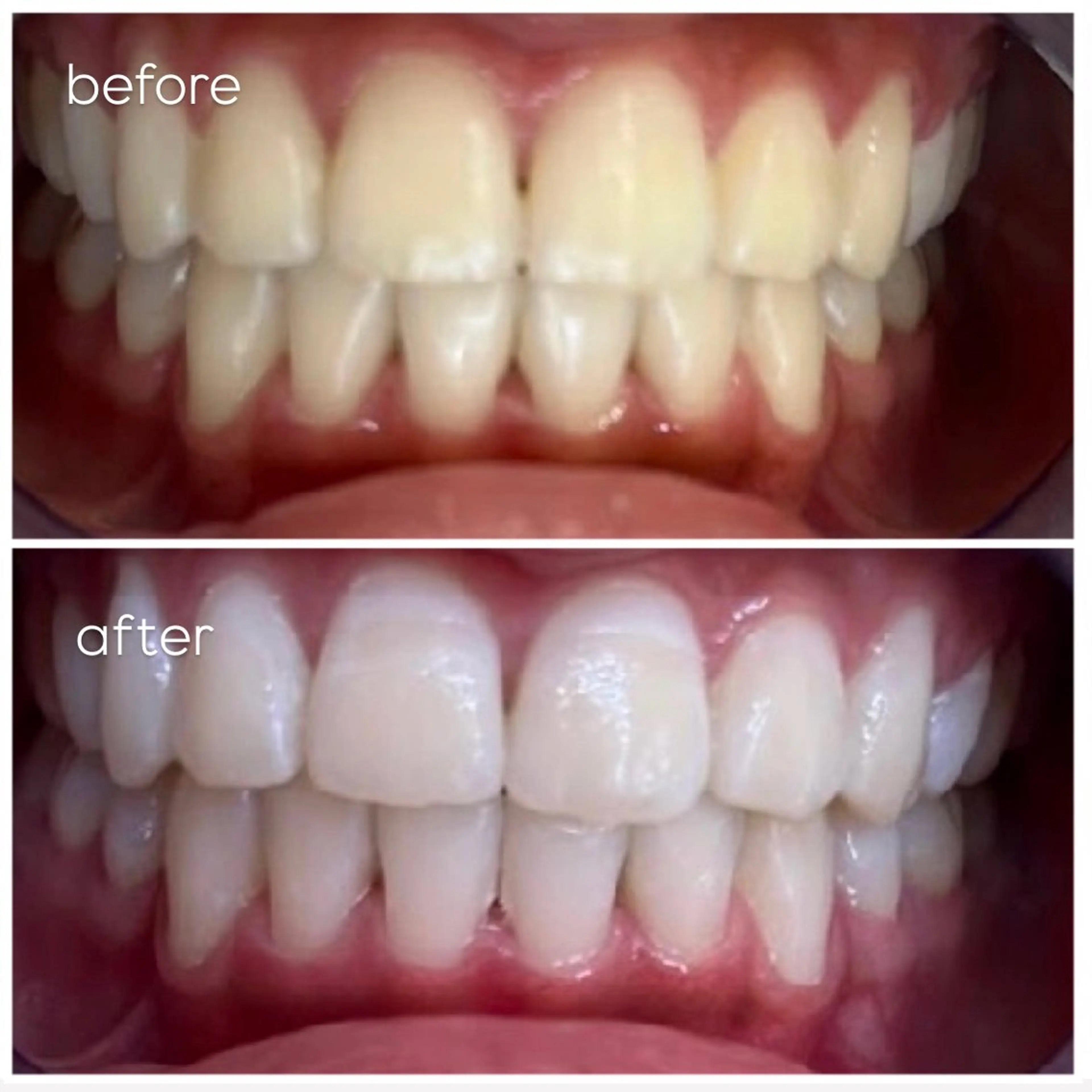 エクシア津駅前店所属・セルフホワイトニング エクシア津駅前店のその他イメージ