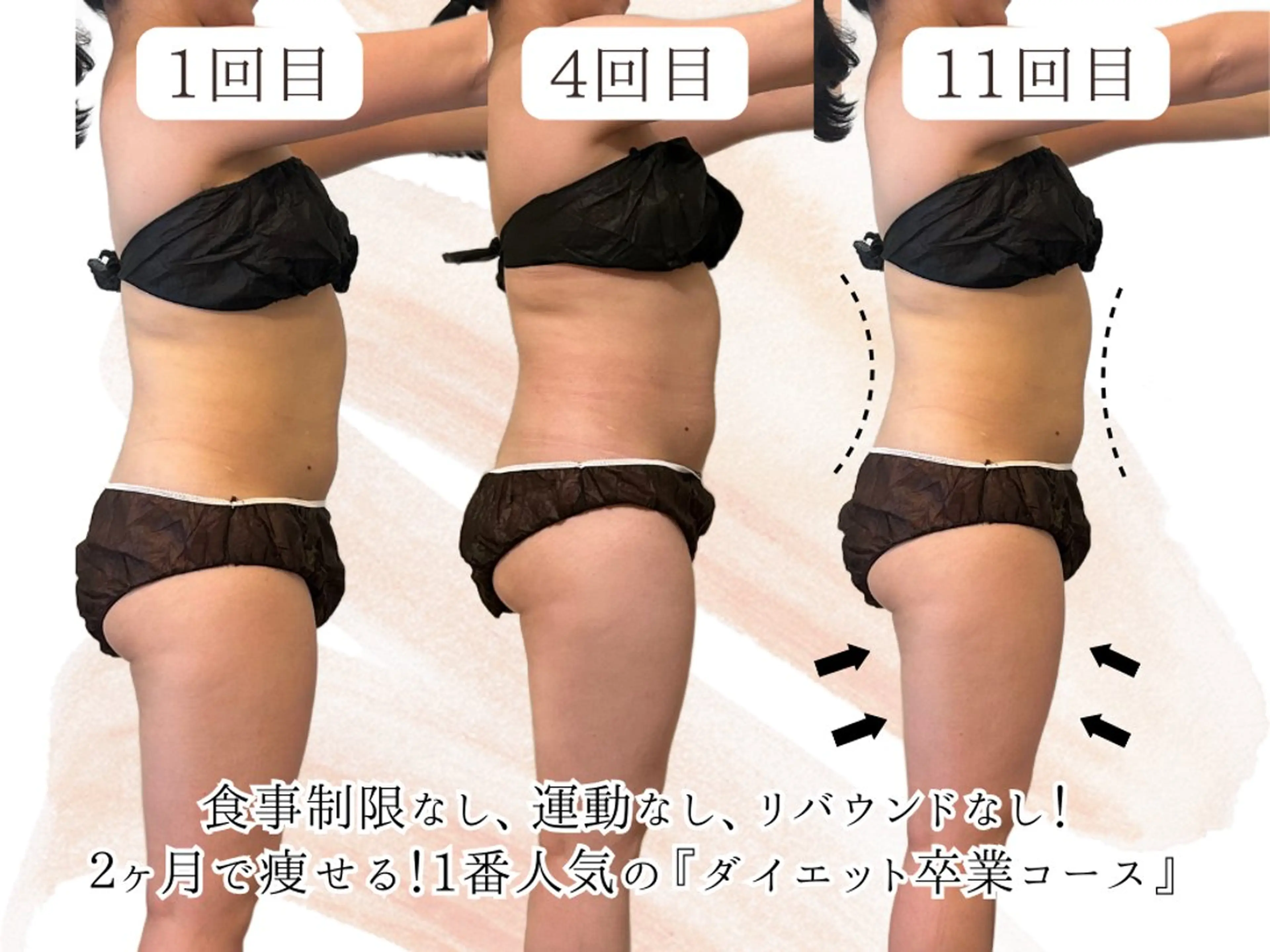 一番人気⭐︎ダイエット卒業コース！(水素吸入込み！) ¥11800 → ¥9800の写真