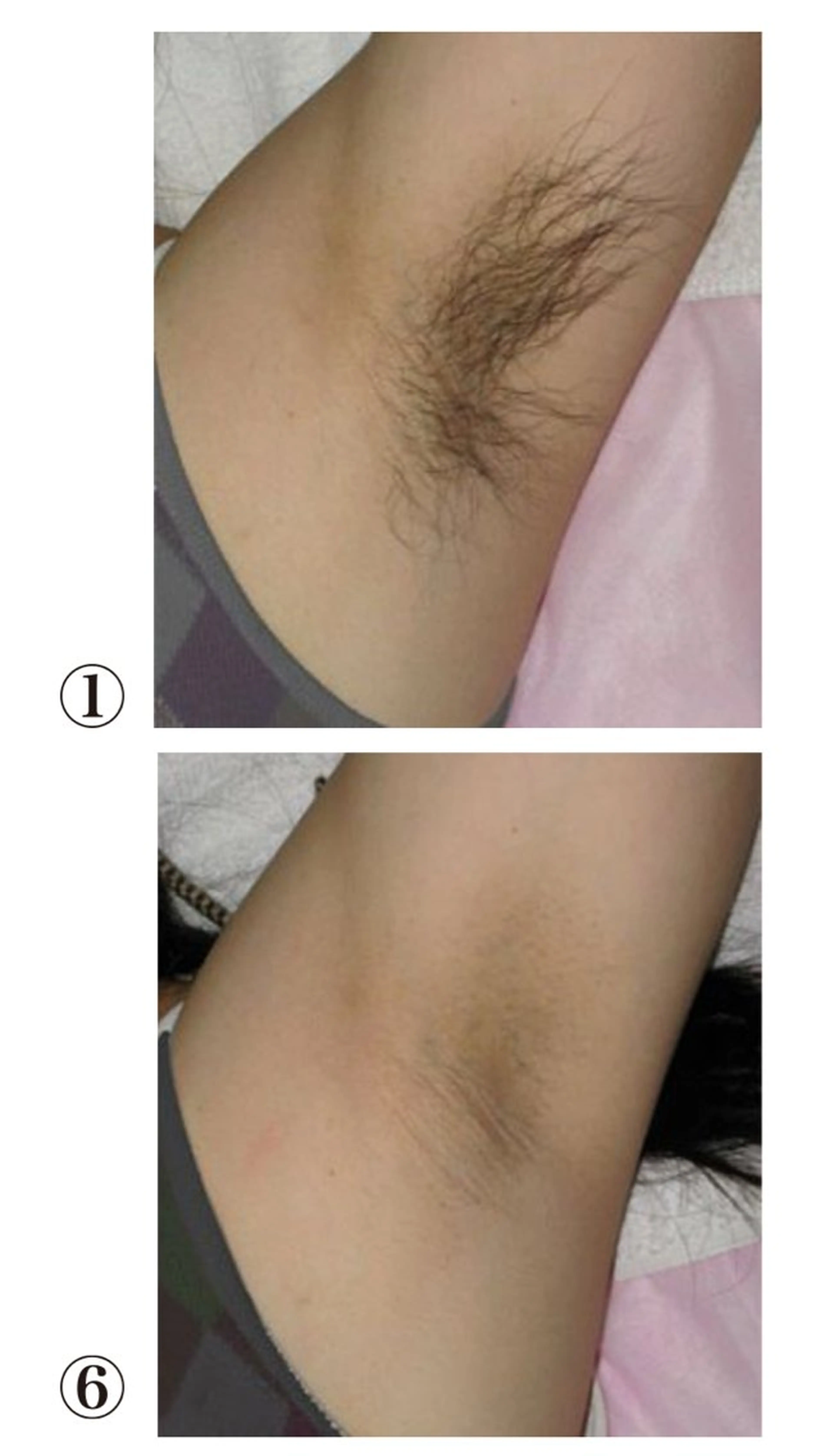 メンズ 脱毛 脱毛サロン　セラヴィ 吉祥寺 KEITAのエステ・リラクイメージ