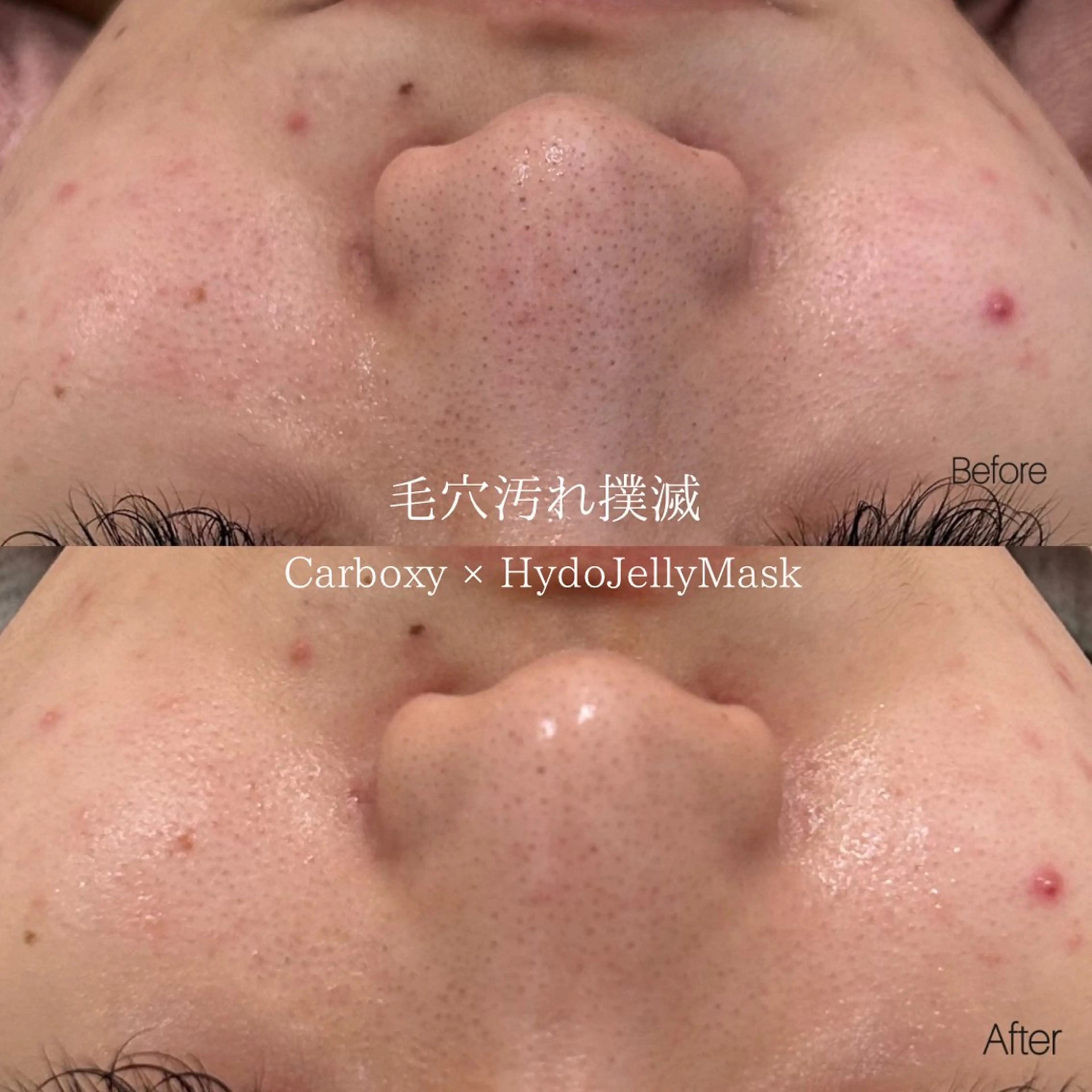 etre - 韓国肌管理 -のエステ・リラクイメージ