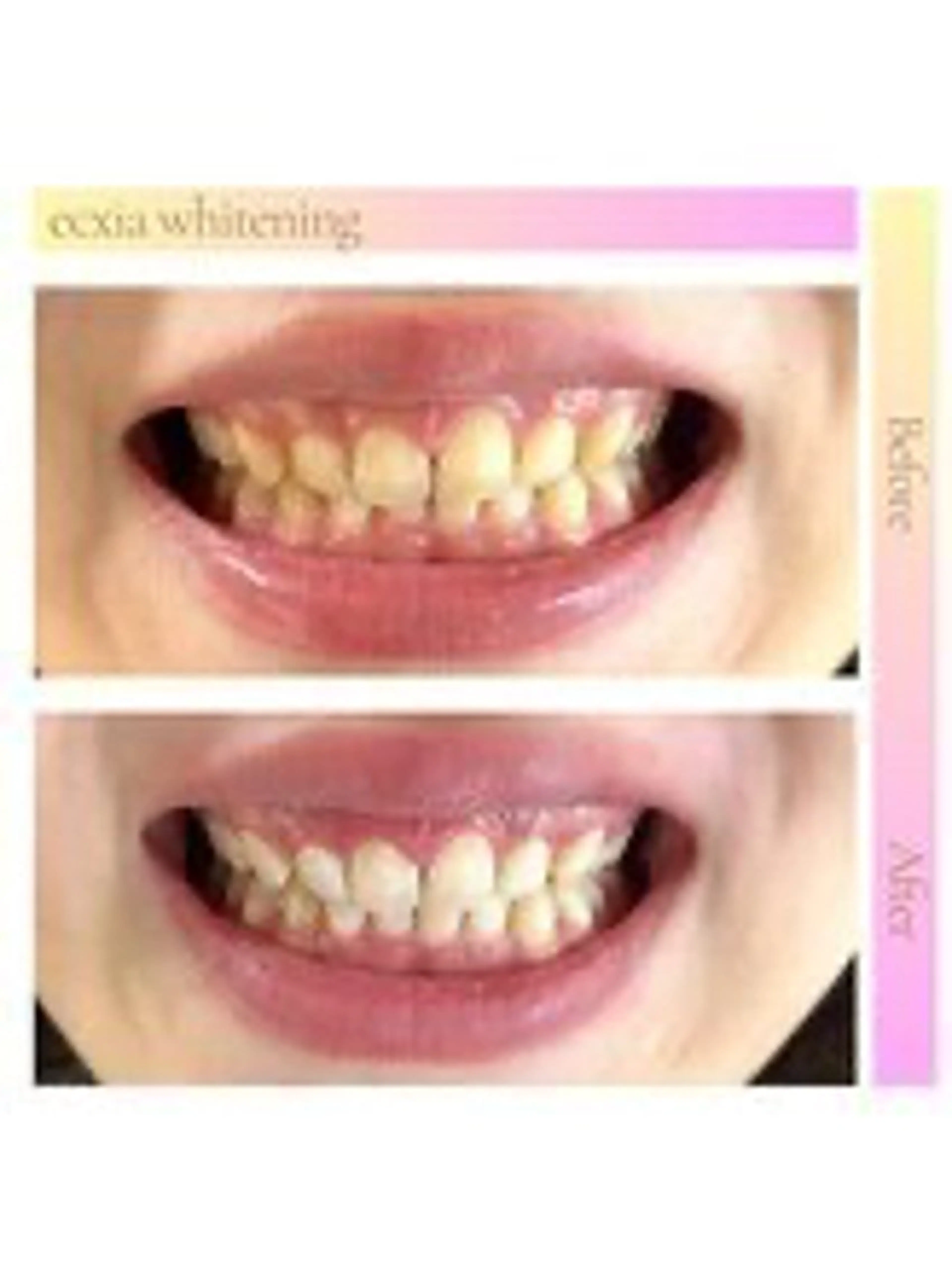 セルフホワイトニング エクシア西宮北口店のその他イメージ