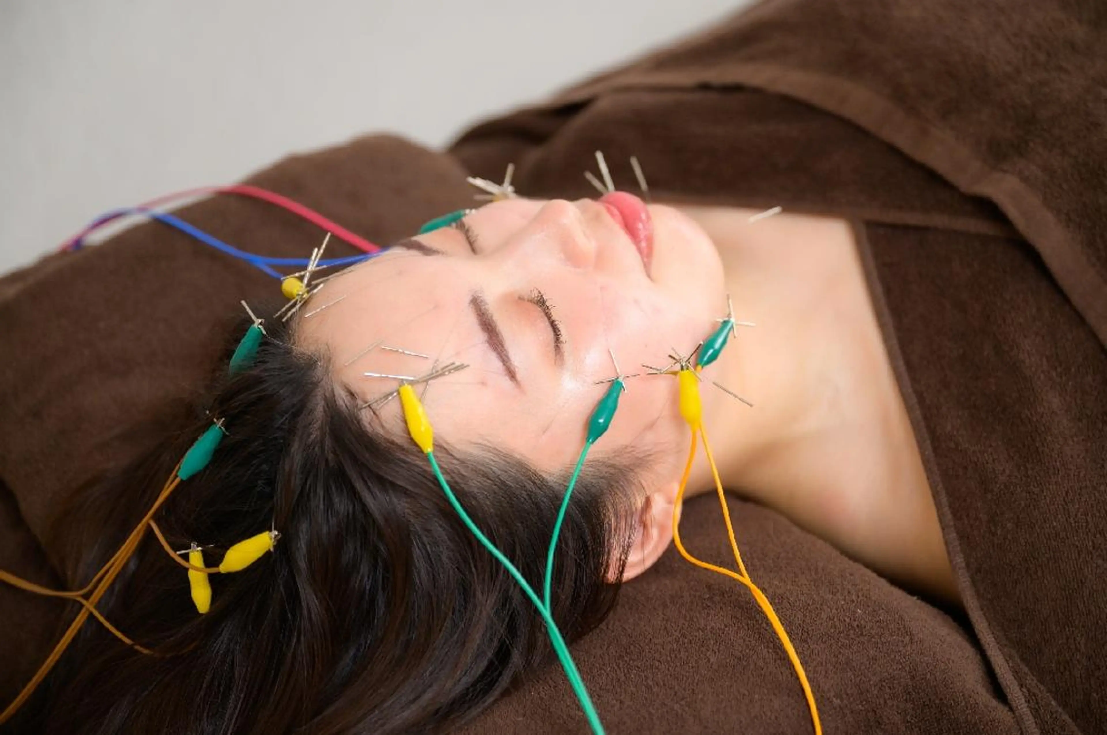 💙美容鍼💙美顔矯 正🧡Brilo🧡のエステ・リラクイメージ